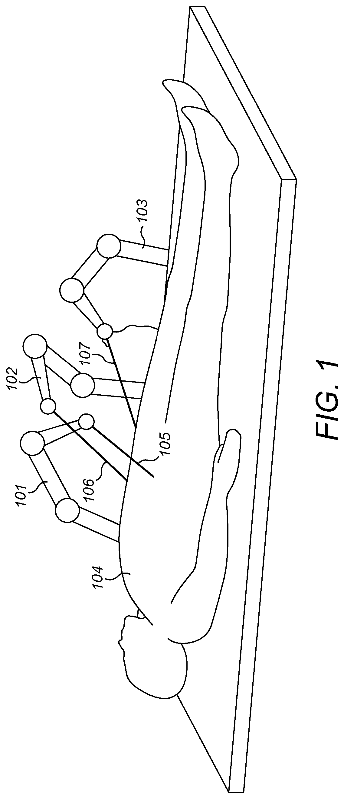 Patent US11771302 — Image correction of a surgical endoscope video stream — Figure 1