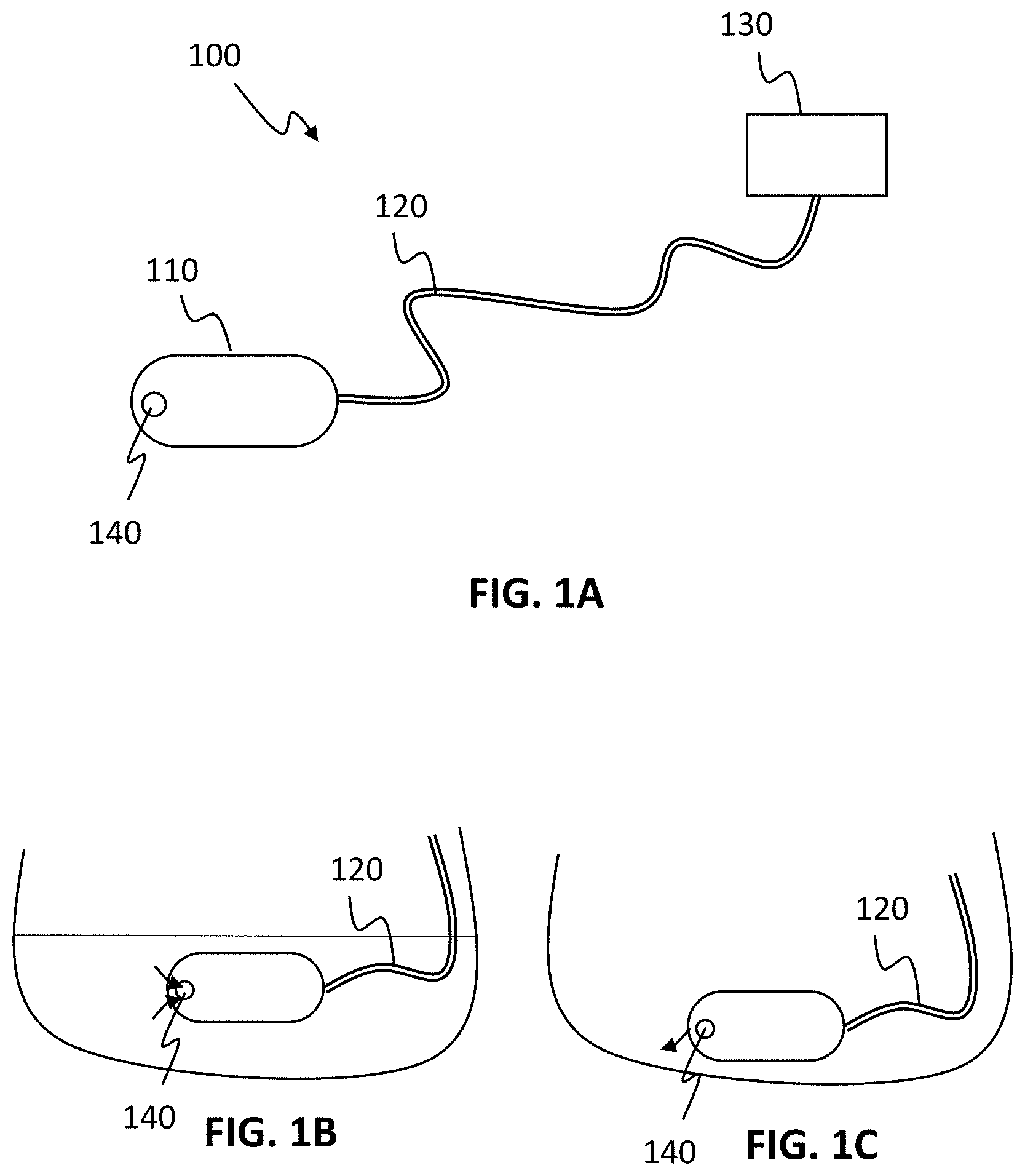 Patent US11771311 Figure 1 – Systems and methods for collecting and screening of pancreatic secretions