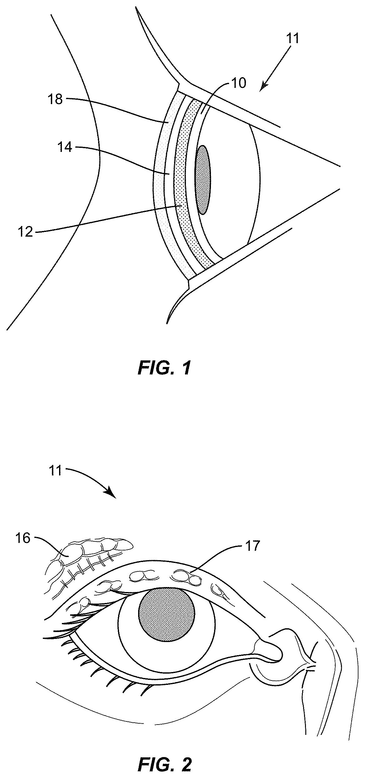 Patent US11771317 — Ocular surface interferometry (OSI) for imaging, processing, and/or displaying an ocular tear film — Figure 1