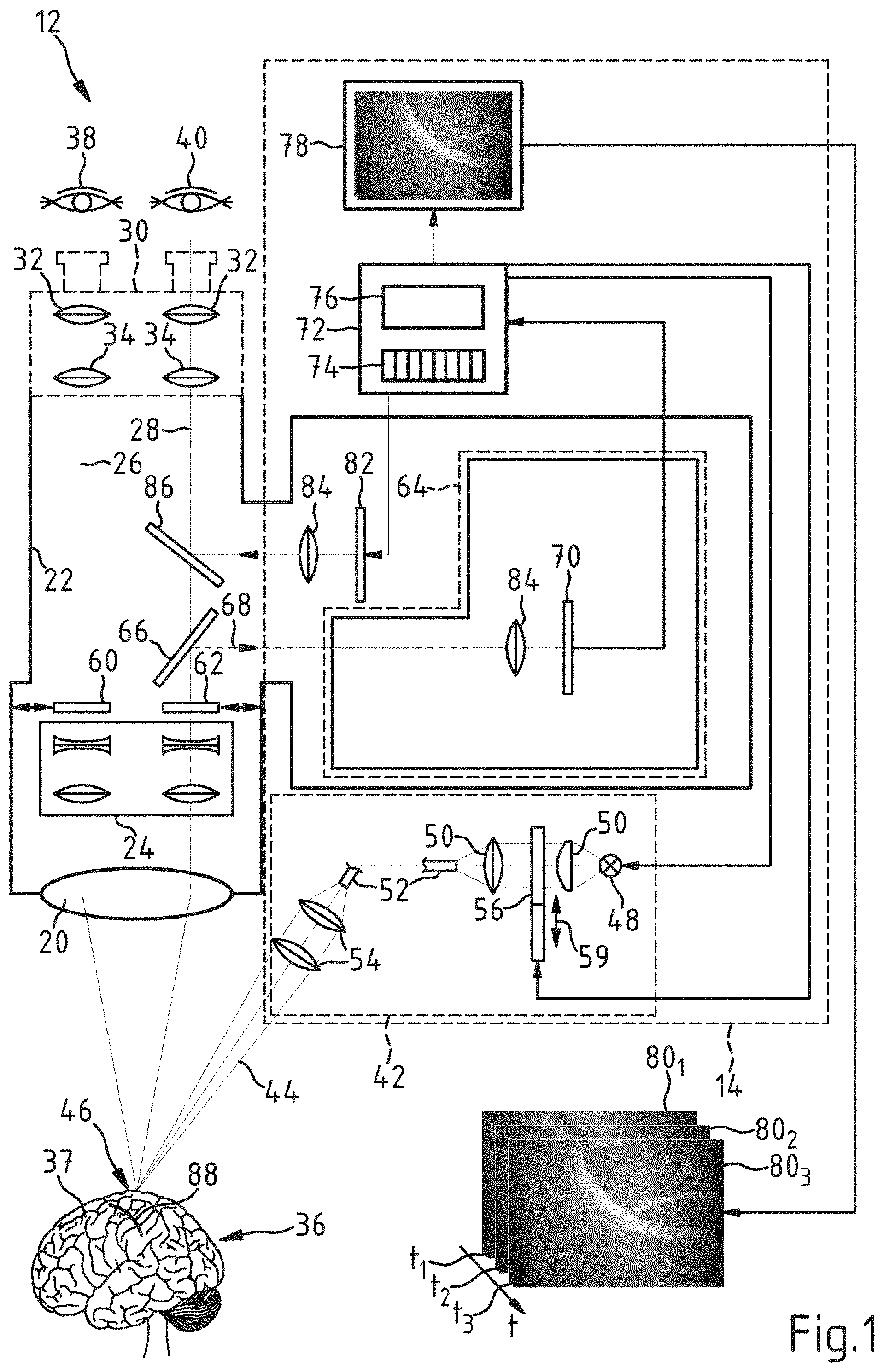 Patent US11771322 — Computer-implemented method, computer program and surgical system for determining the volumetric flow rate of blood through a portion of a blood vessel in a surgical field — Figure 1