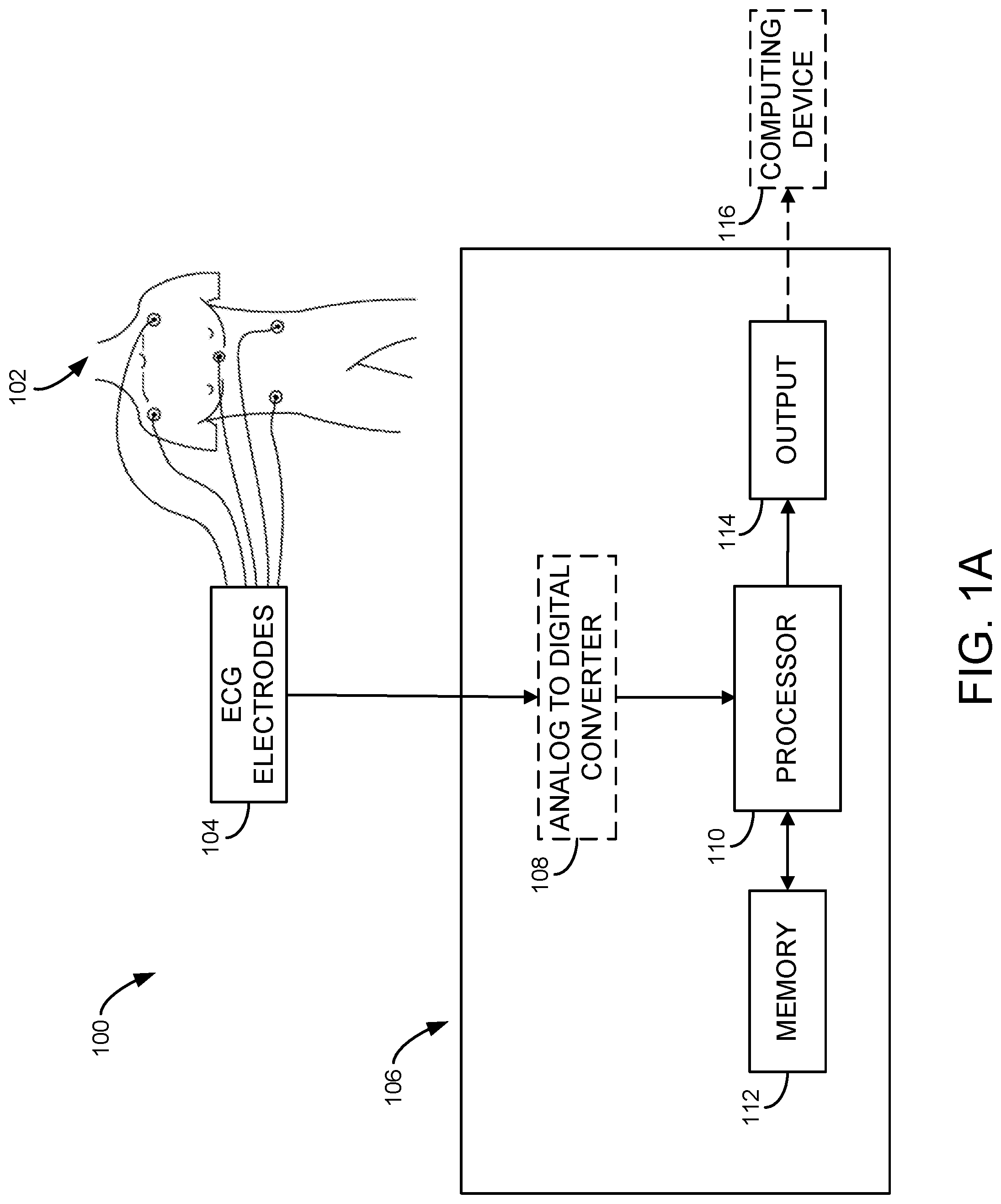 Patent US11771330 — System and method for processing cardiac signals and providing reports to users regarding impending or ongoing medical conditions — Figure 1