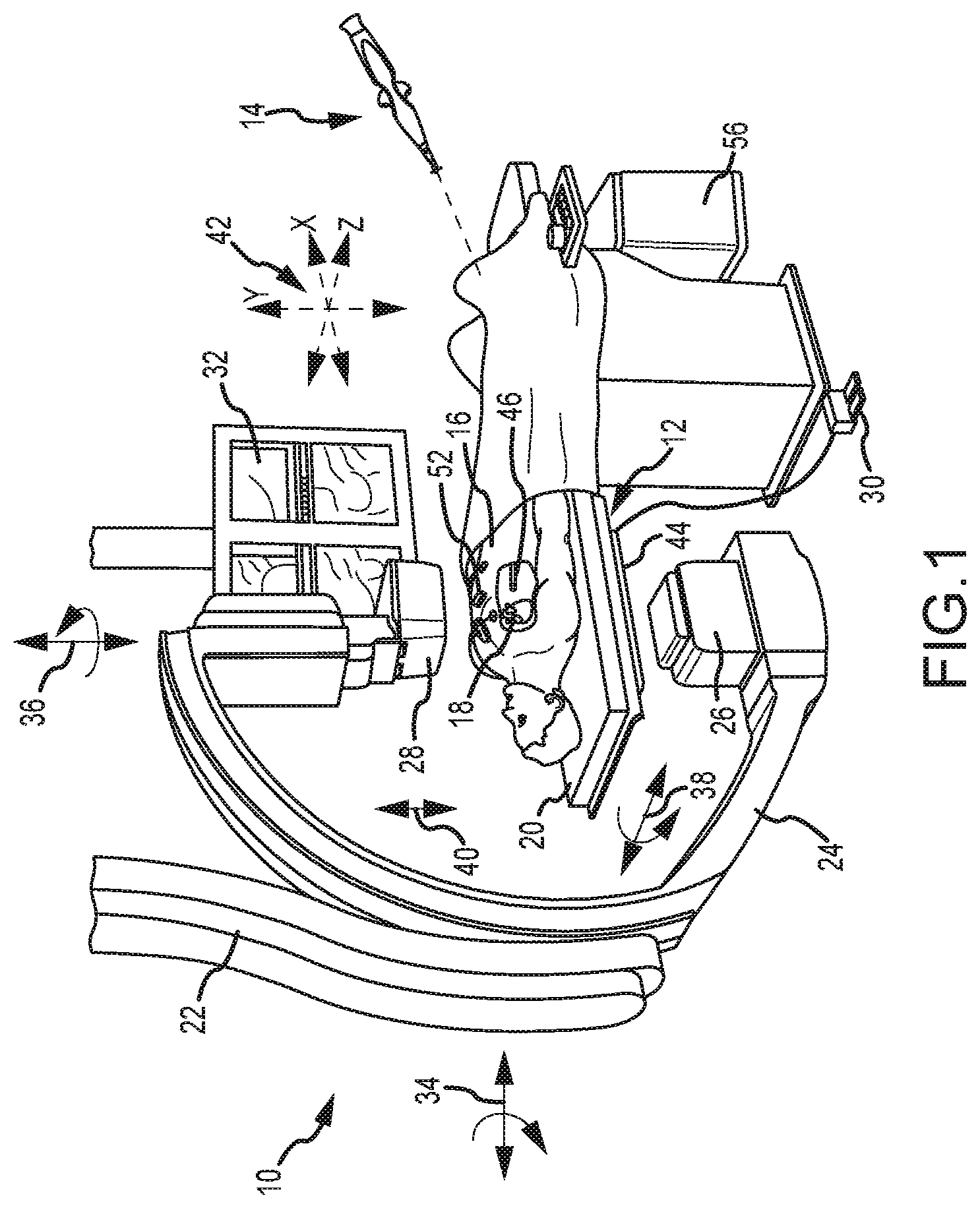 Patent US11771337 — Magnetic field generator with minimal image occlusion and minimal impact on dimensions in c-arm x-ray environments — Figure 1