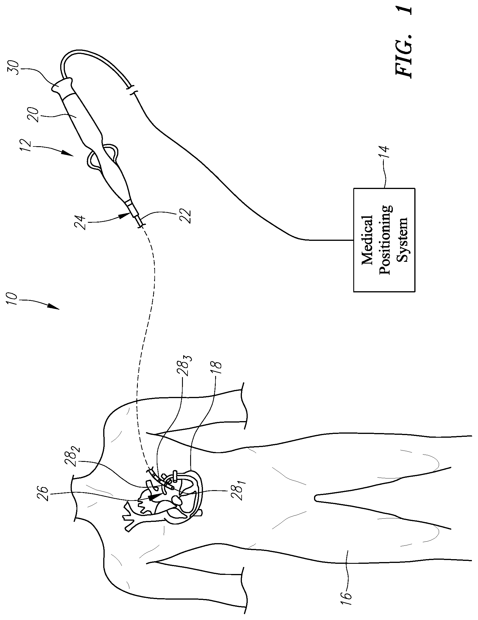 Patent US11771338 — Localized magnetic field generator — Figure 1