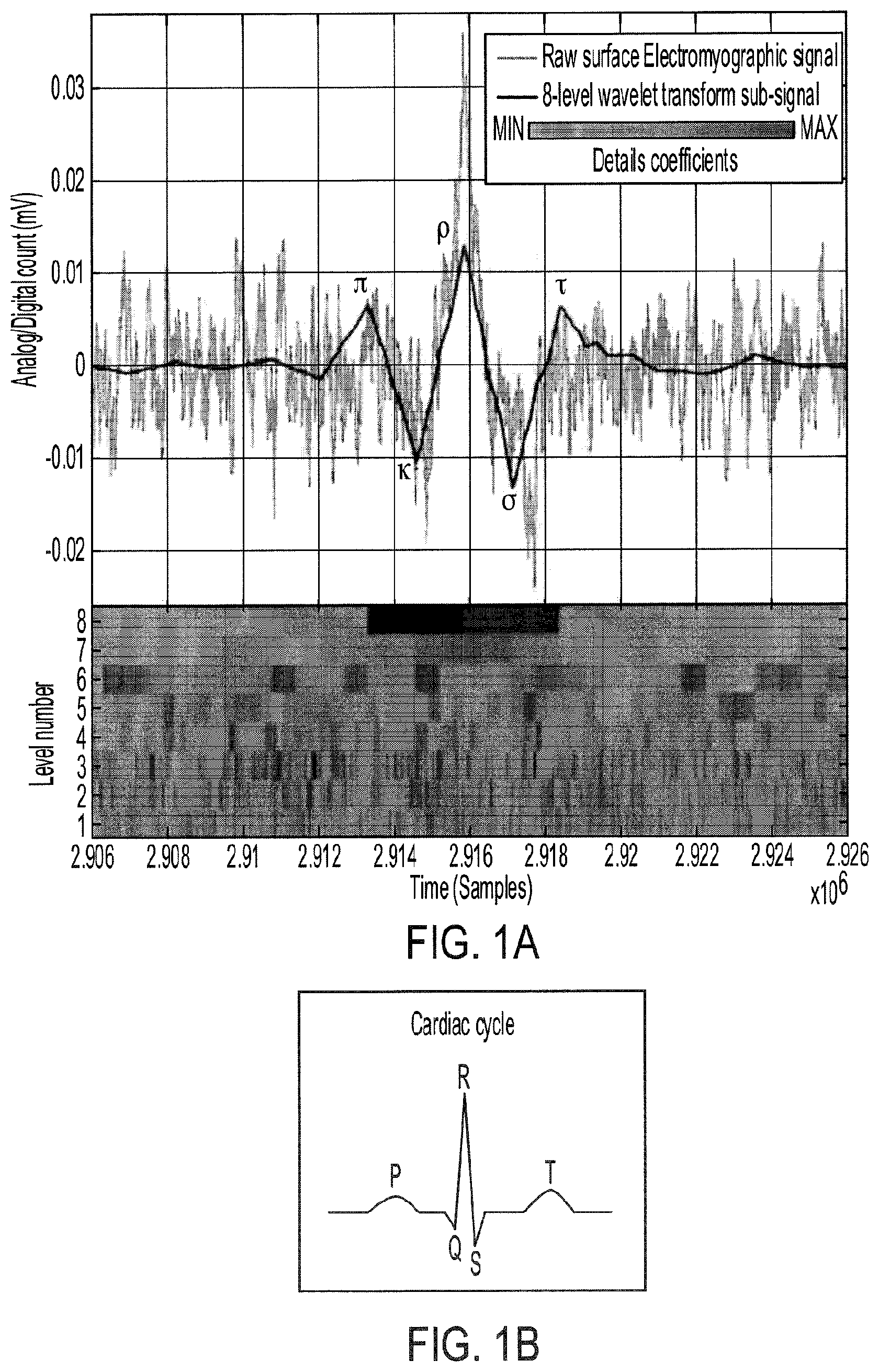 Patent US11771358 — Rhythmic synchronization of motor neuron discharges and their burst rate variability — Figure 1