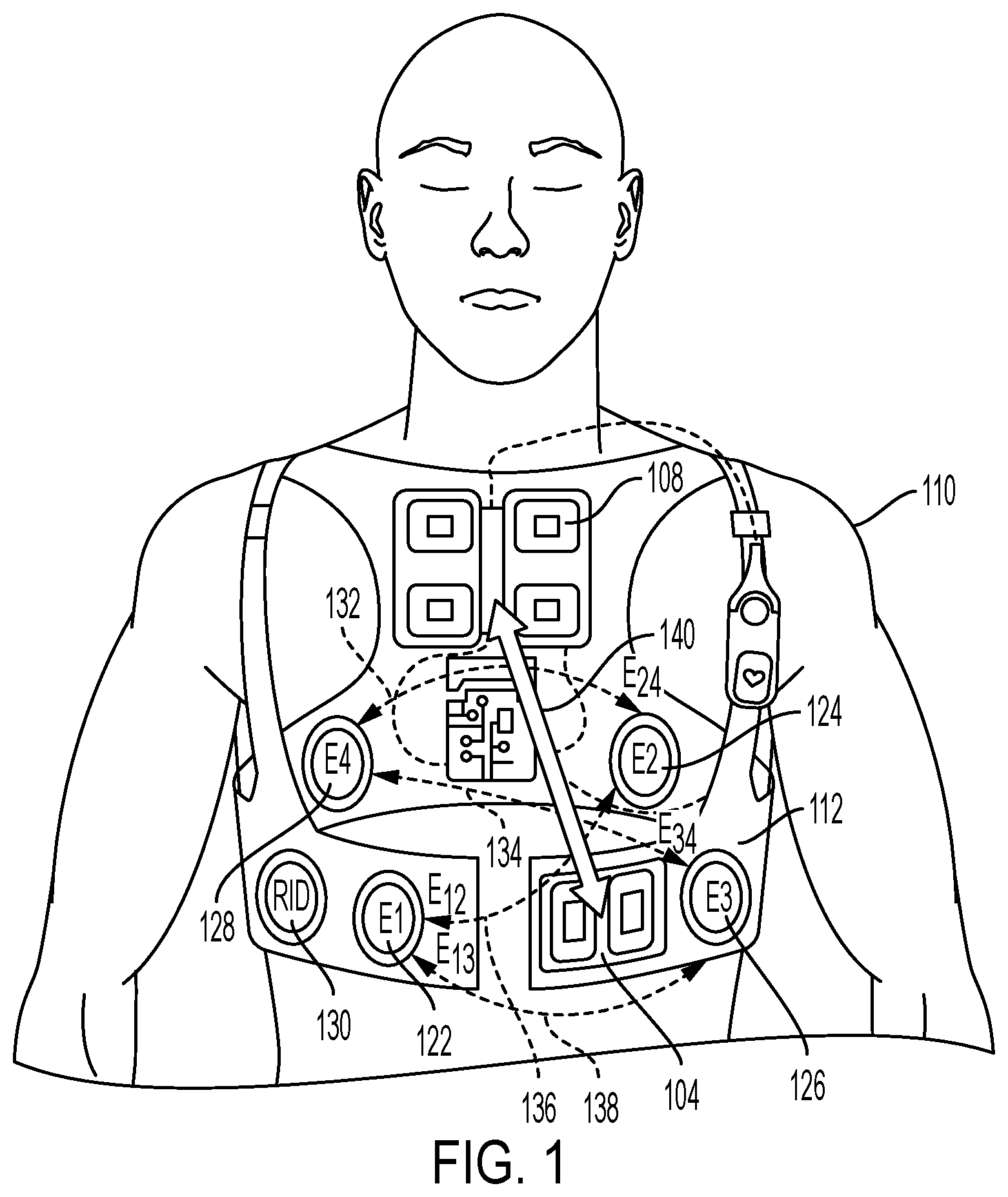 Patent US11771360 — Cardiac monitoring system with normally conducted QRS complex identification — Figure 1