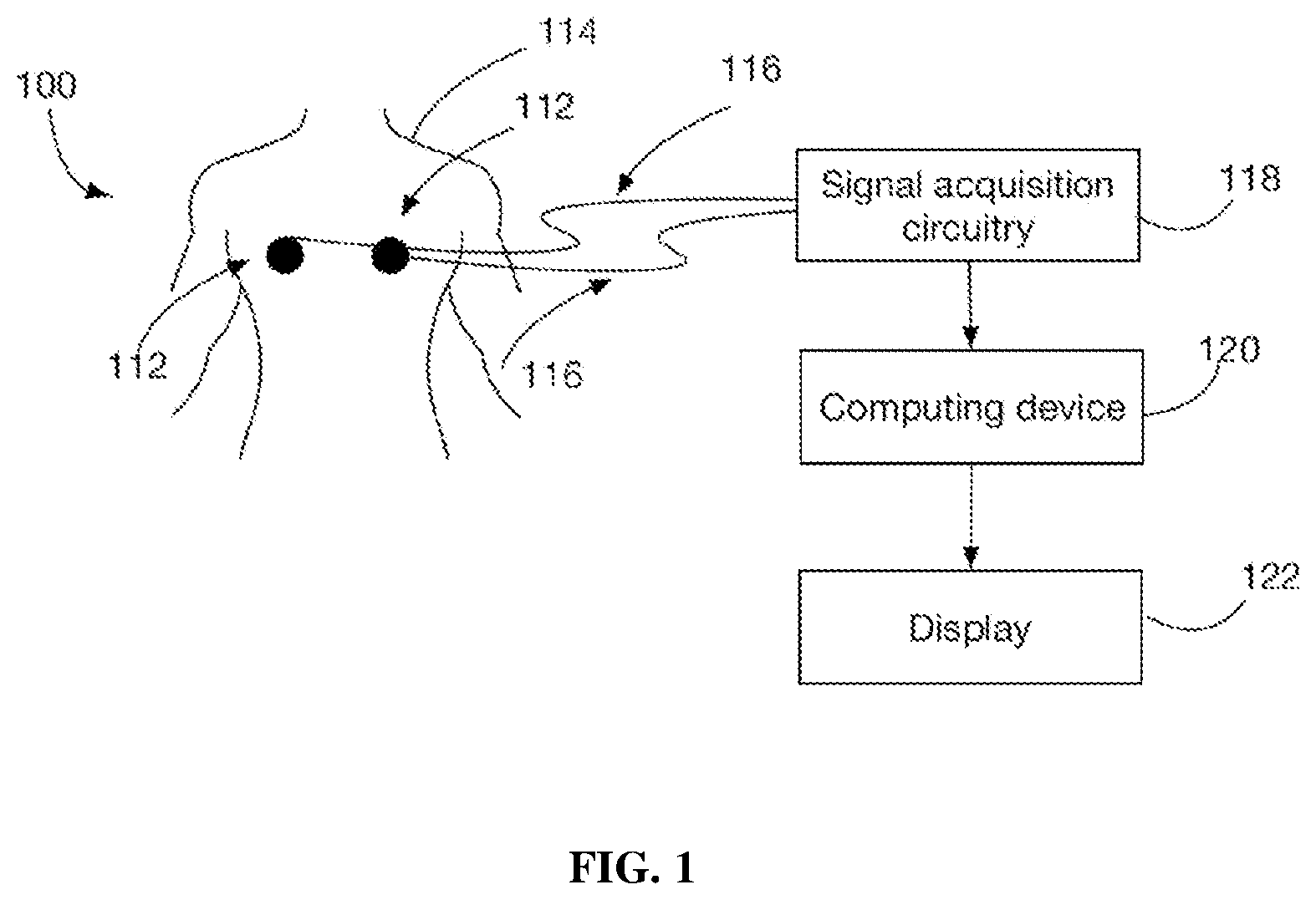 Patent US11771361 Figure 1 – Method and system for determining QRS onset in cardiac signals