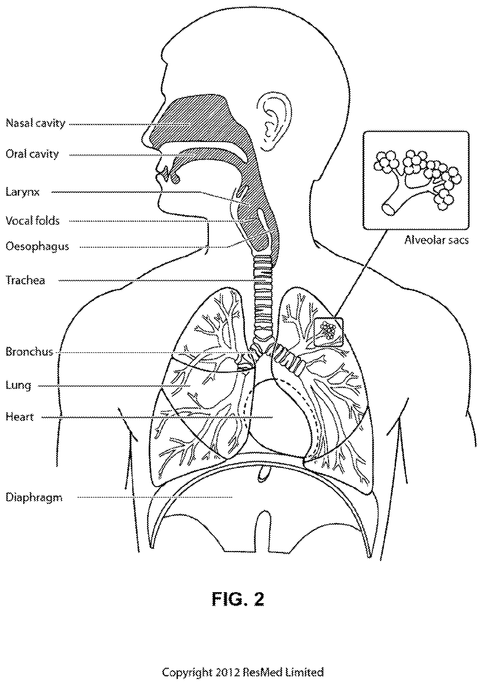 Patent US11771365 Figure 2 – Systems and methods for screening, diagnosis and monitoring sleep-disordered breathing