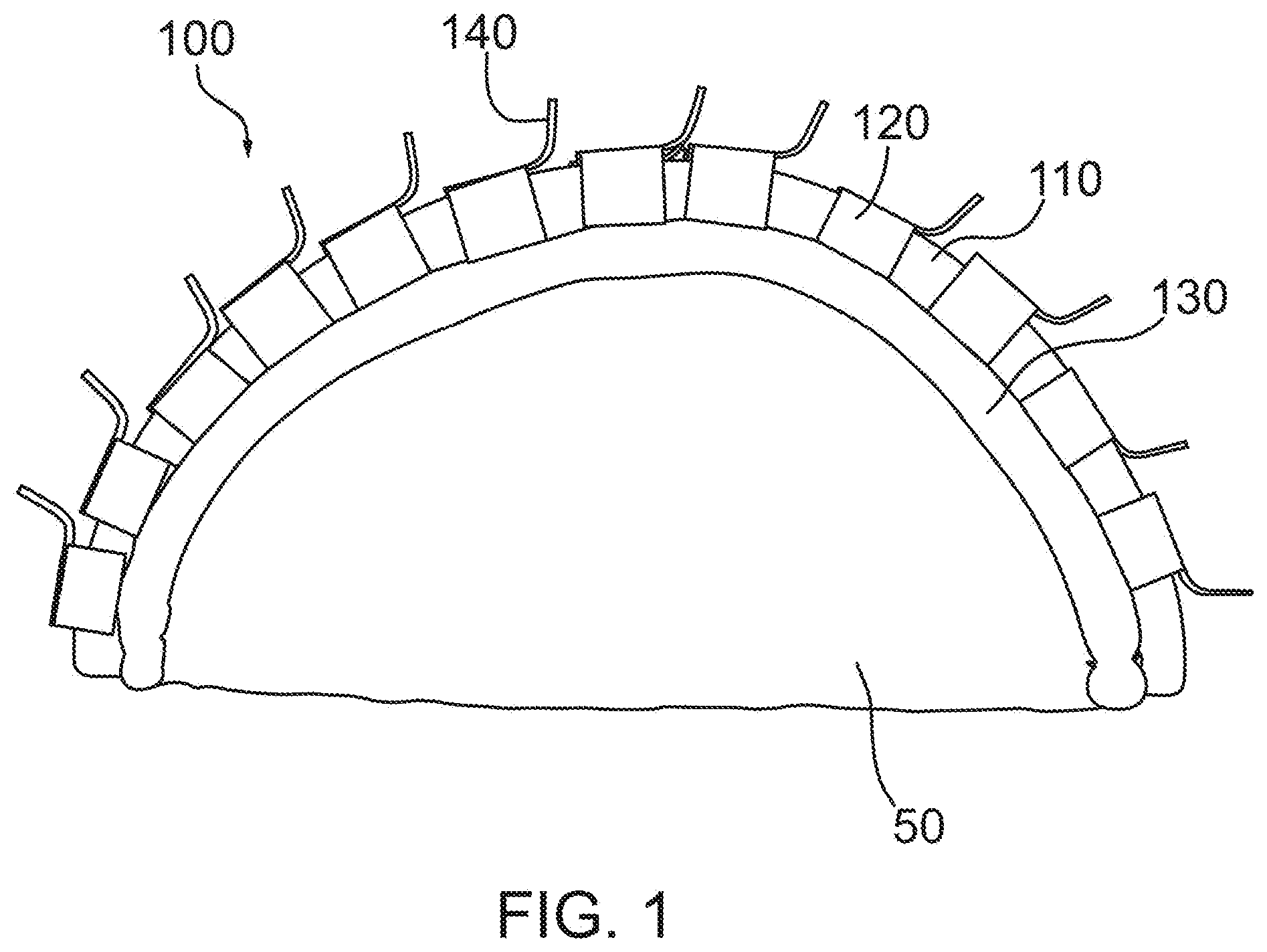 Patent US11771370 — Patient-specific headset for diagnostic and therapeutic transcranial procedures — Figure 1