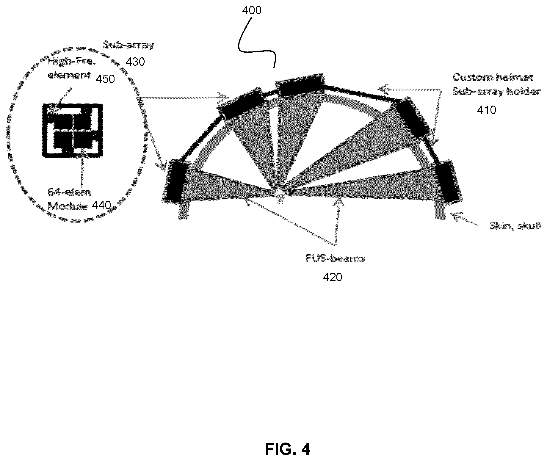 Patent US11771370 Figure 4 – Patient-specific headset for diagnostic and therapeutic transcranial procedures