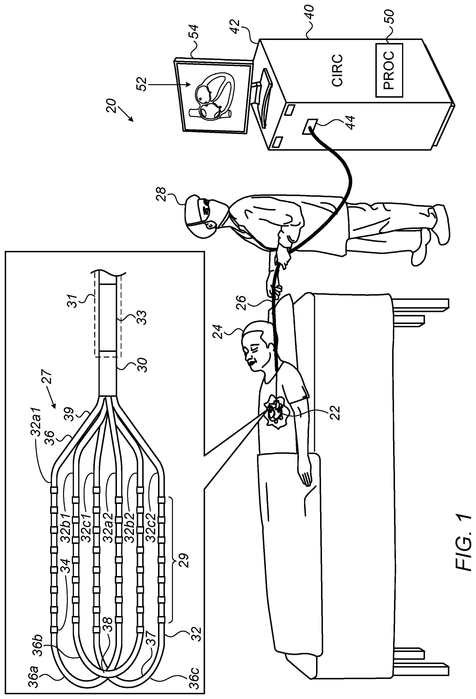 Patent US11771373 — Staggered electrode arrangements for electrophysiological sensing — Figure 1