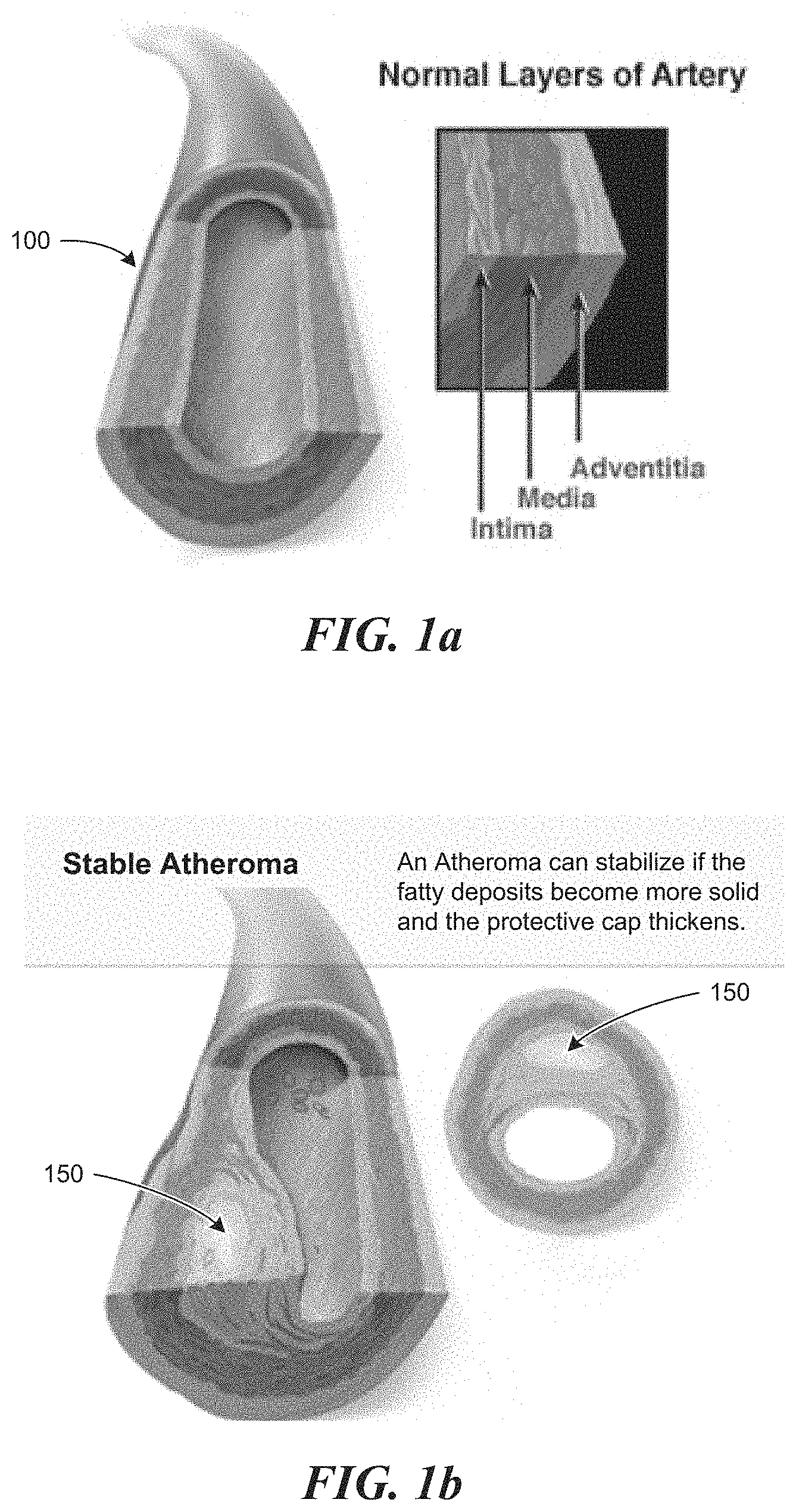 Patent US11771399 — Apparatus and method to guide ultrasound acquisition of the peripheral arteries in the transverse plane — Figure 1