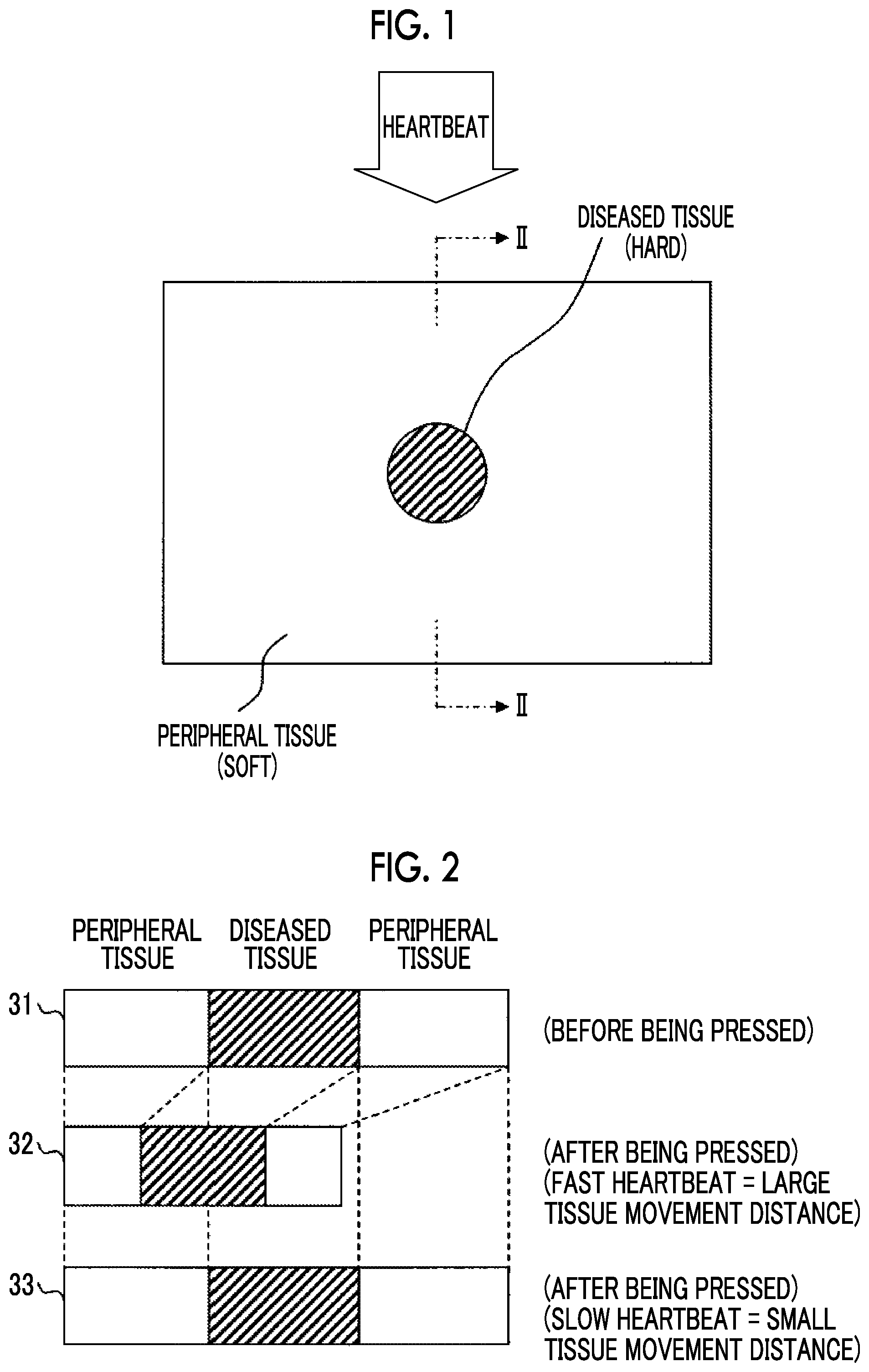 Patent US11771404 — Acoustic wave diagnostic apparatus and control method thereof — Figure 1