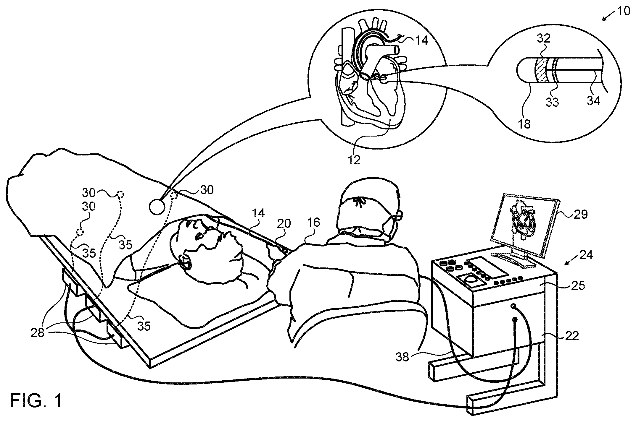 Patent US11771407 — Assistive manual zeroing visualization — Figure 1