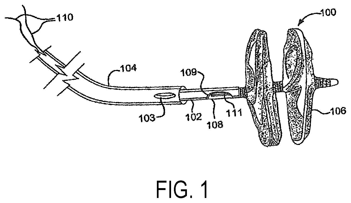 Patent US11771408 — Sealing device and delivery system — Figure 1