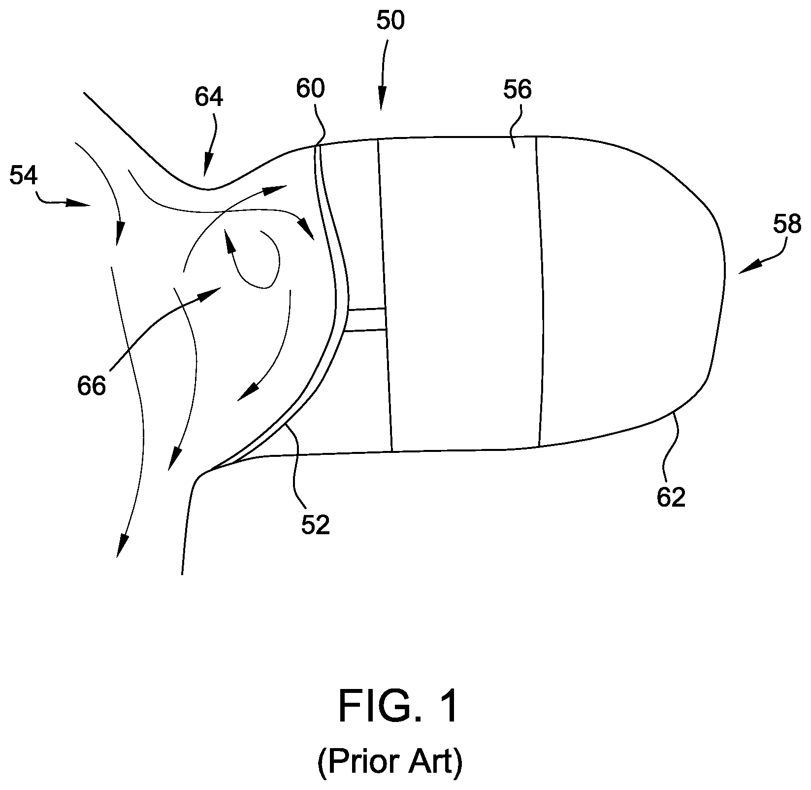 Patent US11771410 — Devices and methods for the treatment of vascular abnormalities — Figure 1