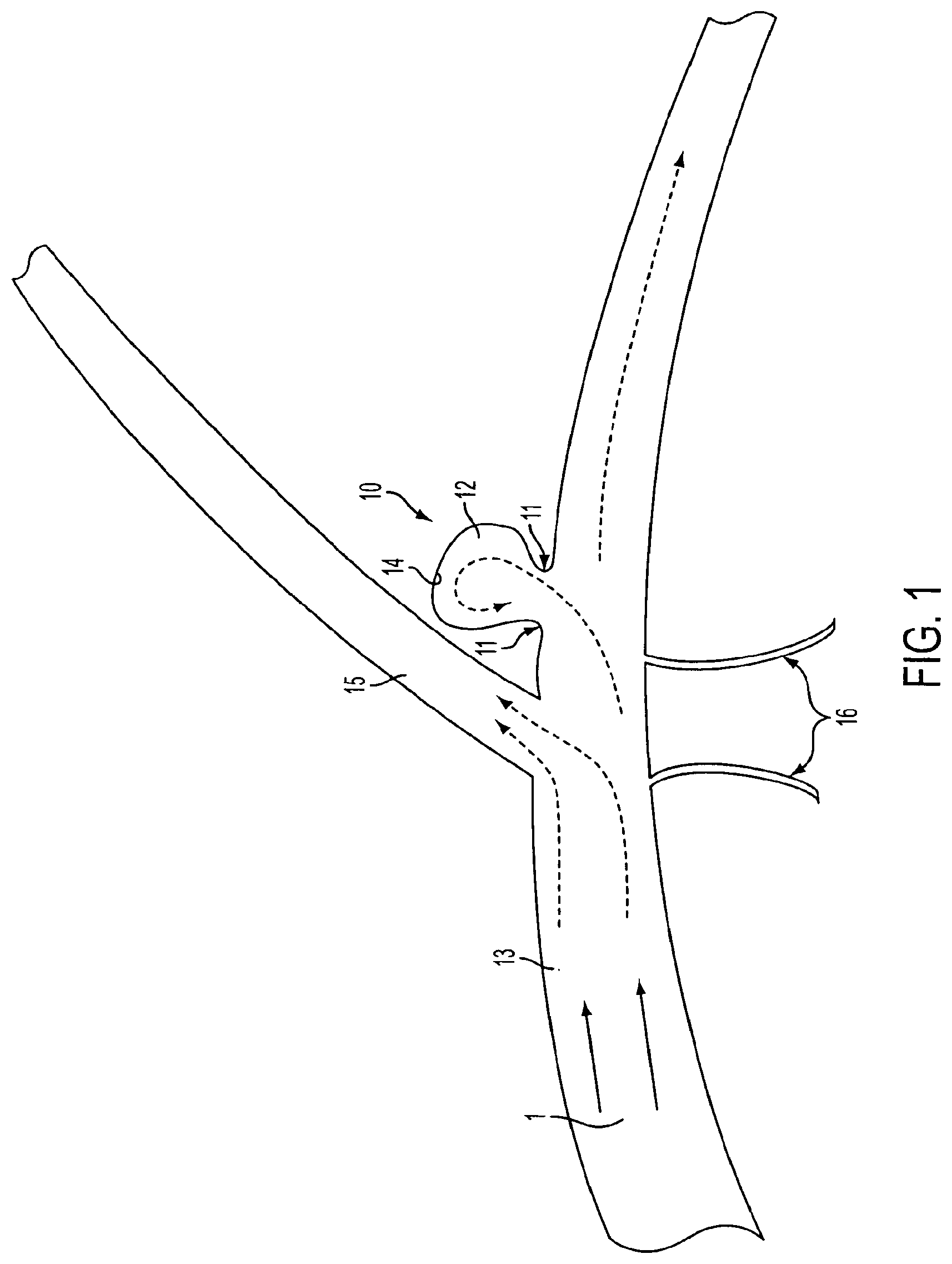 Patent US11771433 Figure 1 – Flexible vascular occluding device