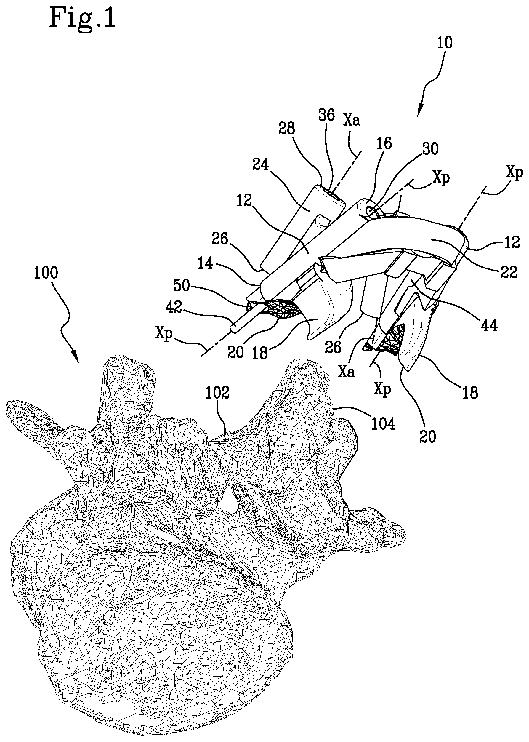 Patent US11771441 — Specific disposable guide device for spinal surgery — Figure 1