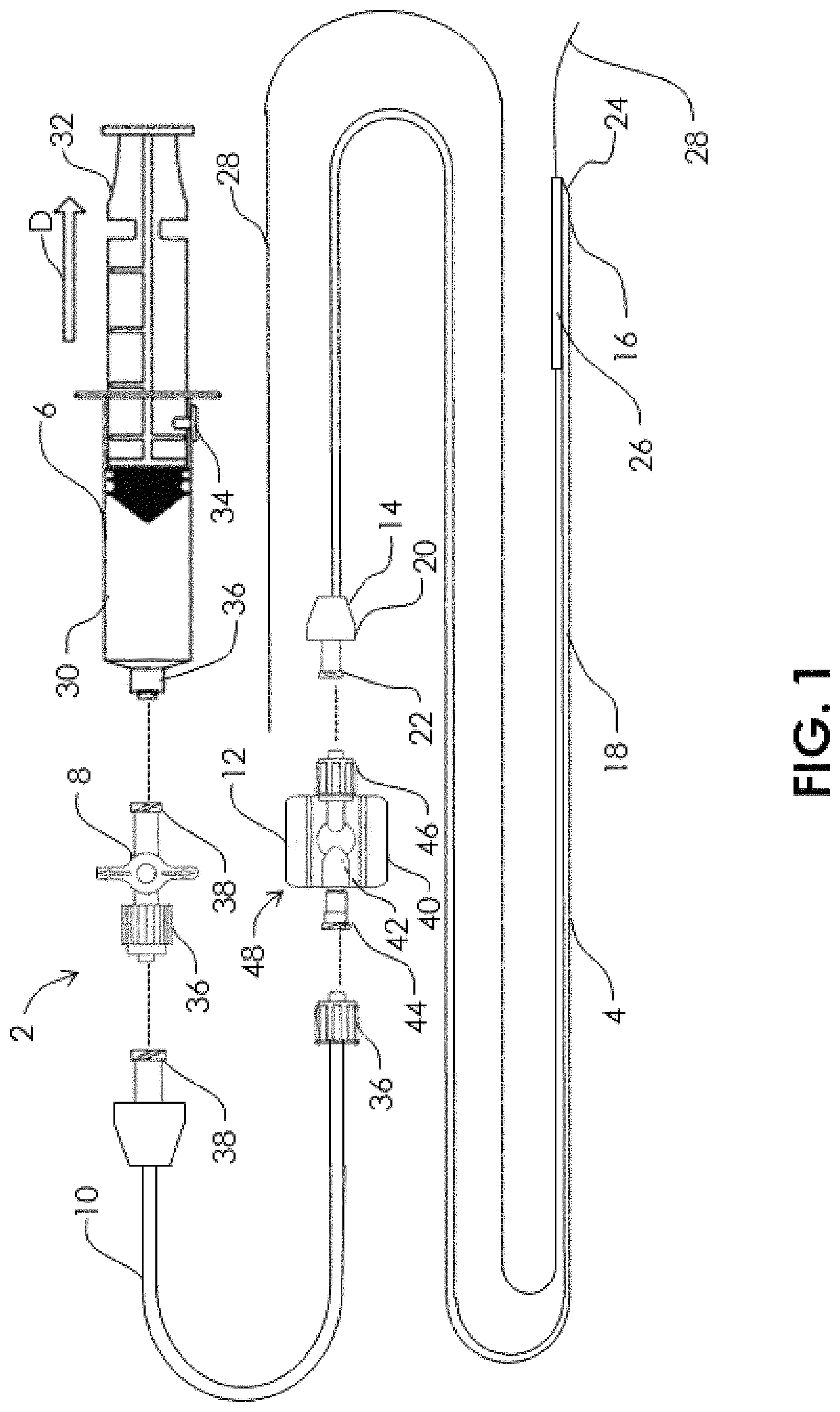 Patent US11771445 — Aspiration monitoring system and method — Figure 1