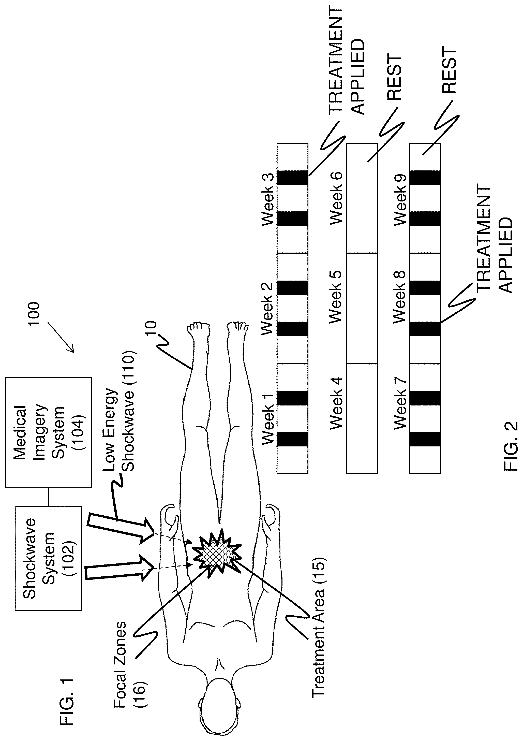 Patent US11771447 — Method of treatment with low energy extracorporeal shockwaves — Figure 1