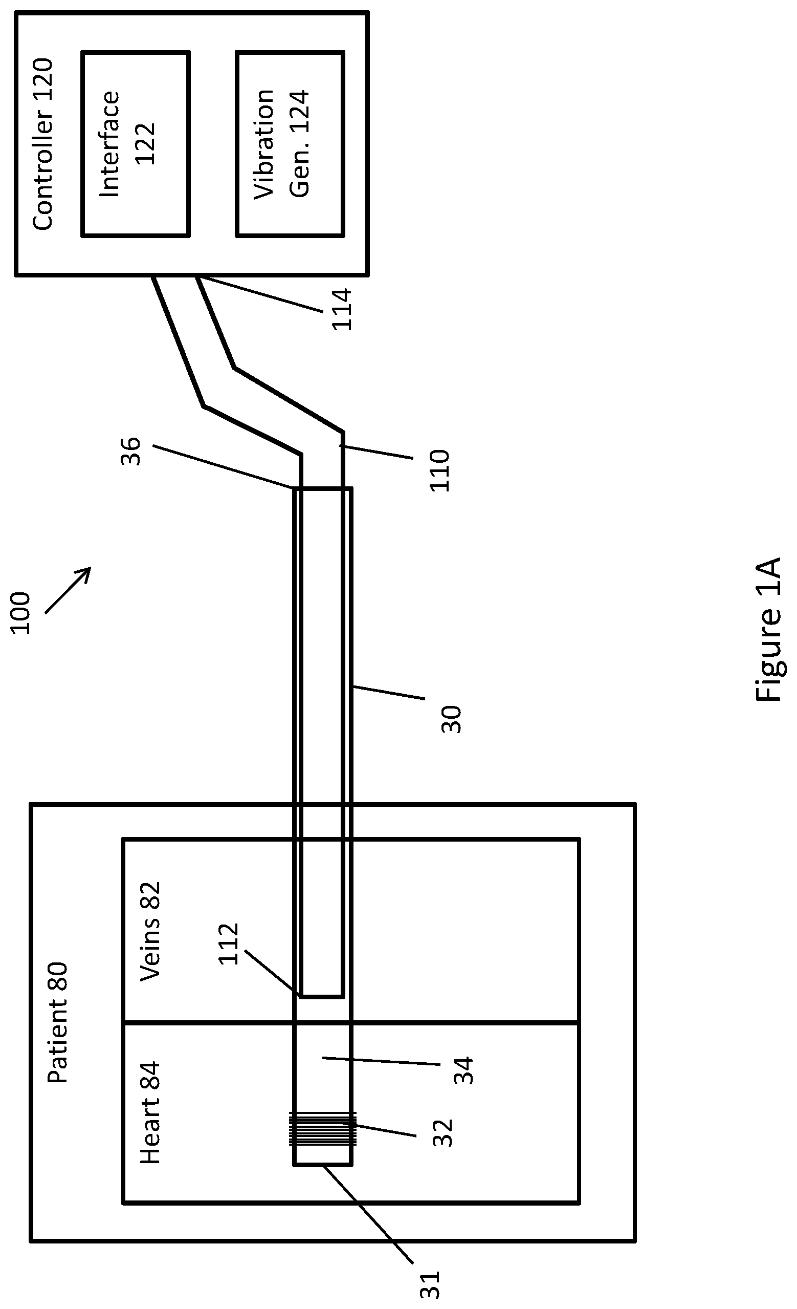 Patent US11771448 — System and method for lead extraction — Figure 1