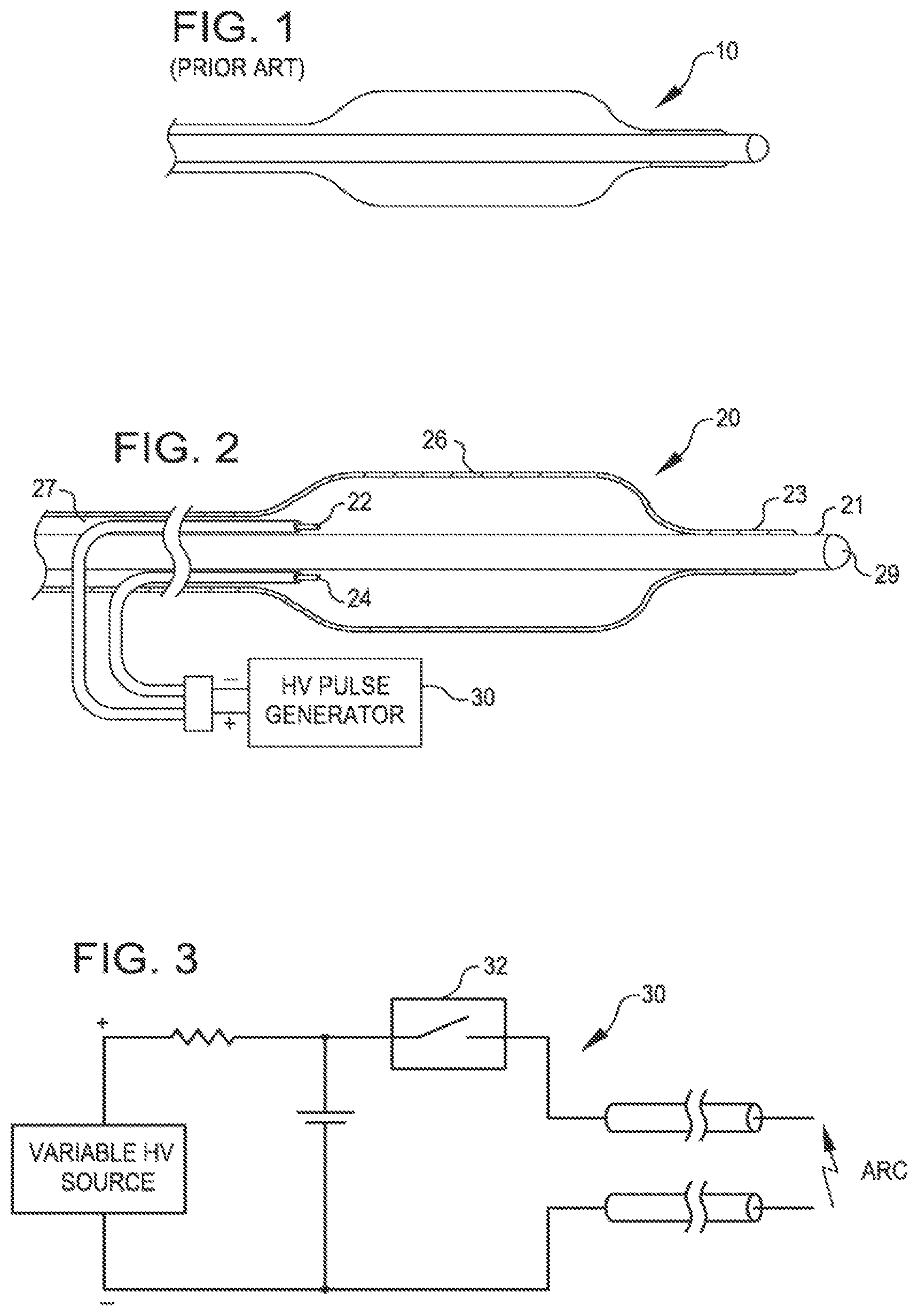 Patent US11771449 — Shockwave balloon catheter system — Figure 1