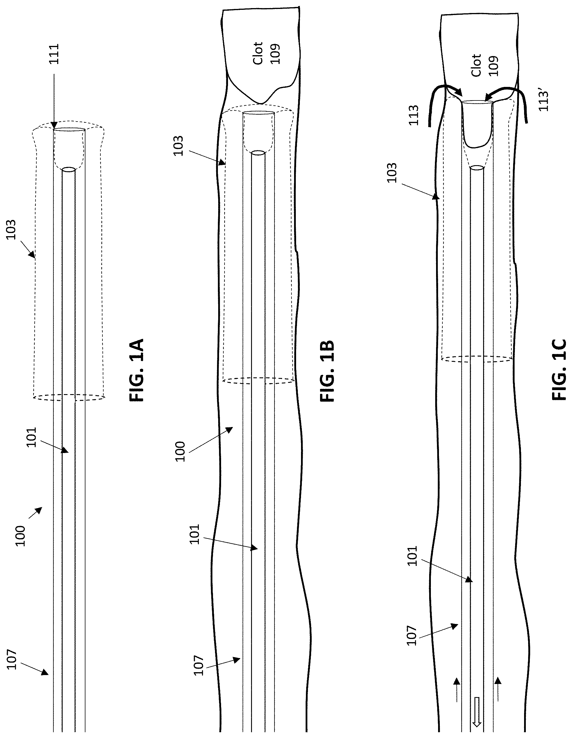 Patent US11771450 — Inverting thrombectomy apparatuses and methods of use — Figure 1