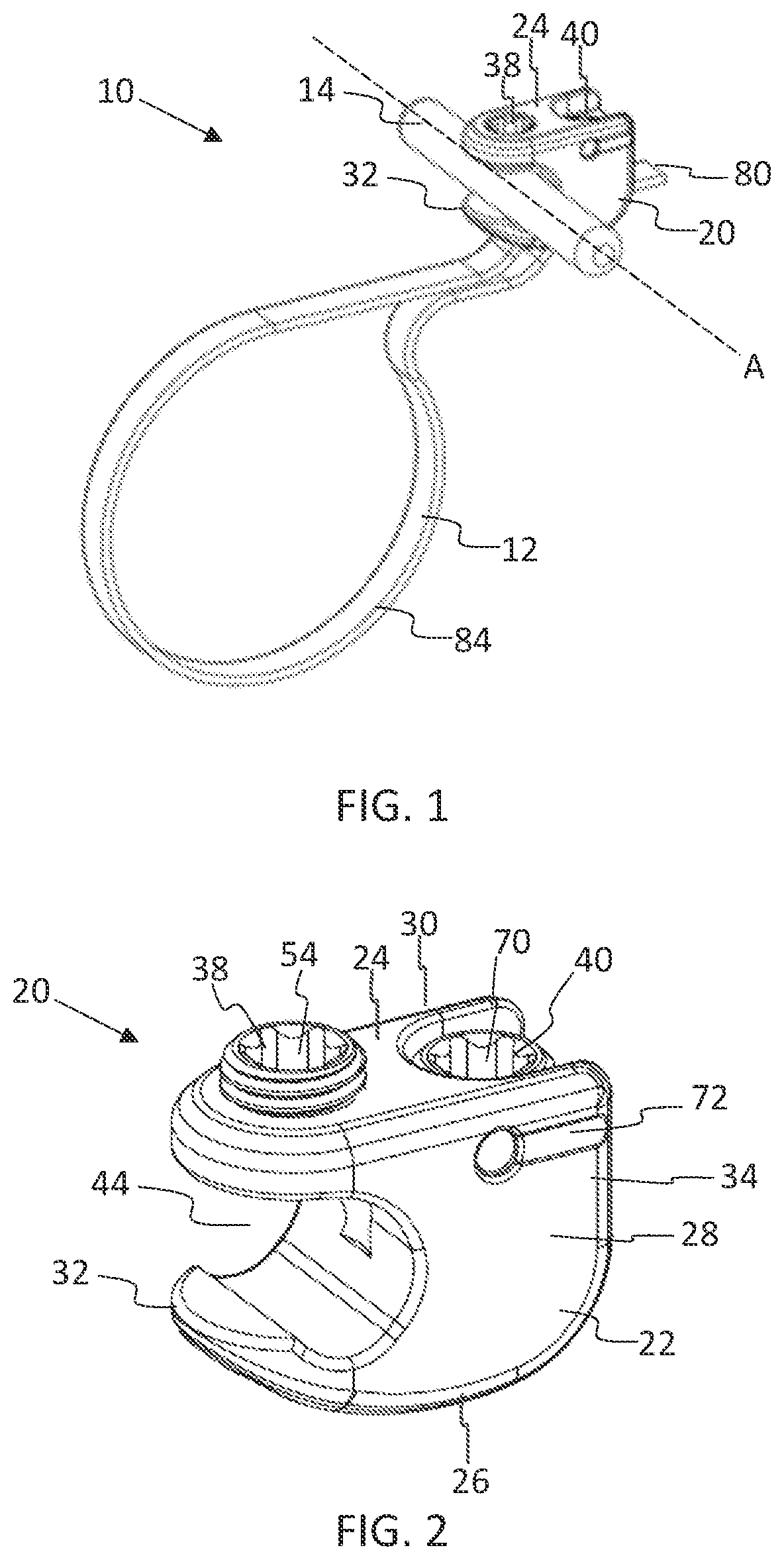 Patent US11771475 — Systems and methods for surgical procedures using band clamp implants and tensioning instruments — Figure 1