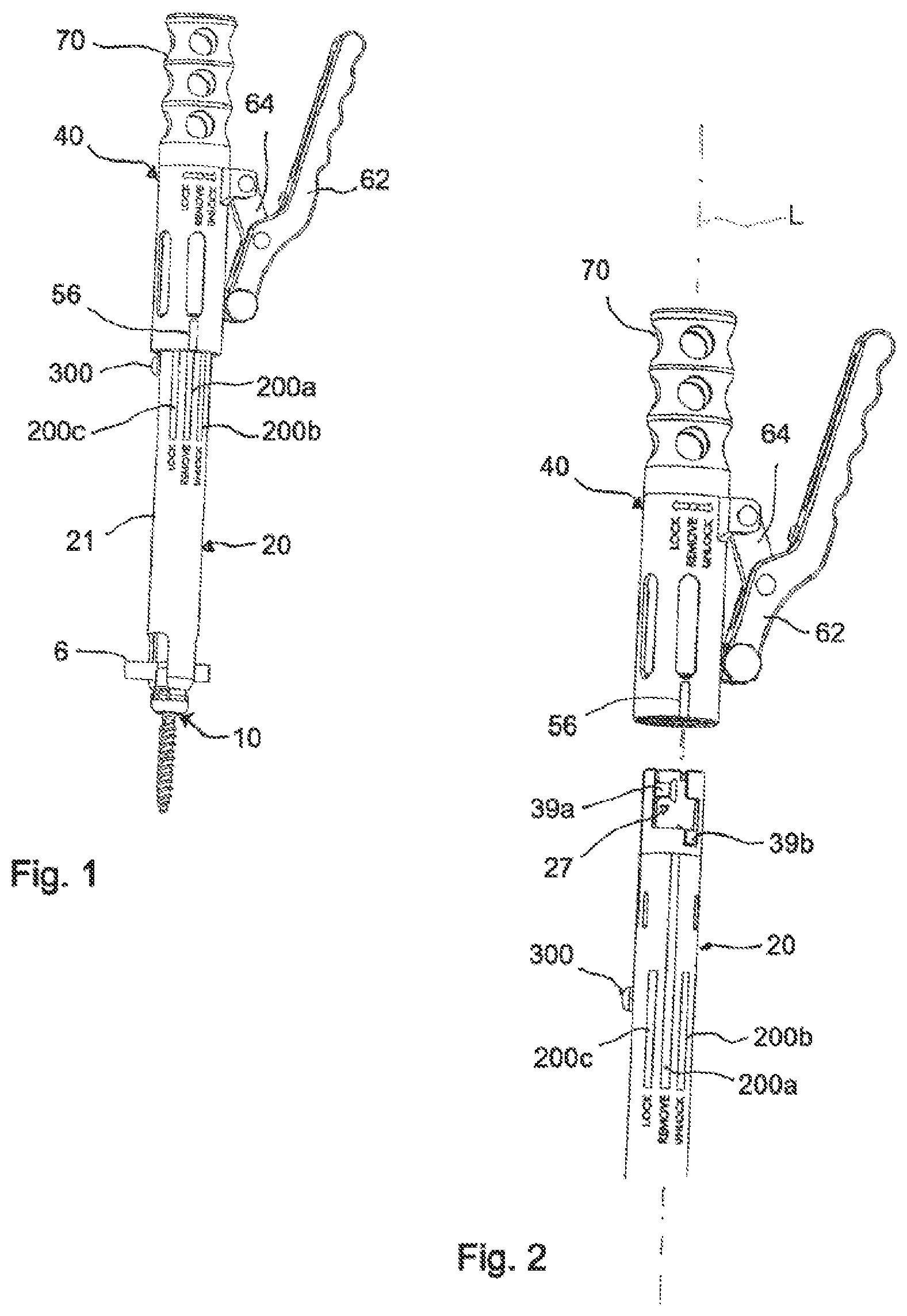 Patent US11771478 — Instrument for locking and unlocking a head of a bone anchor in a polyaxial bone anchoring device — Figure 1