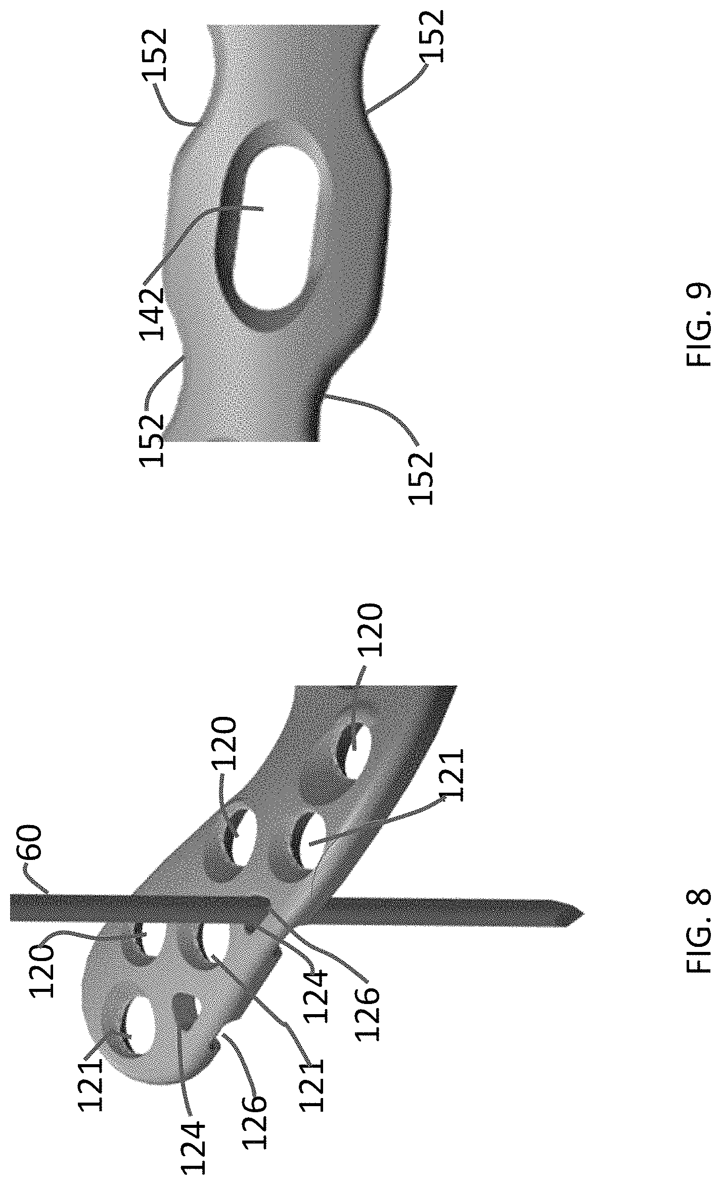 Patent US11771480 Figure 4 – Distal tibial plating system