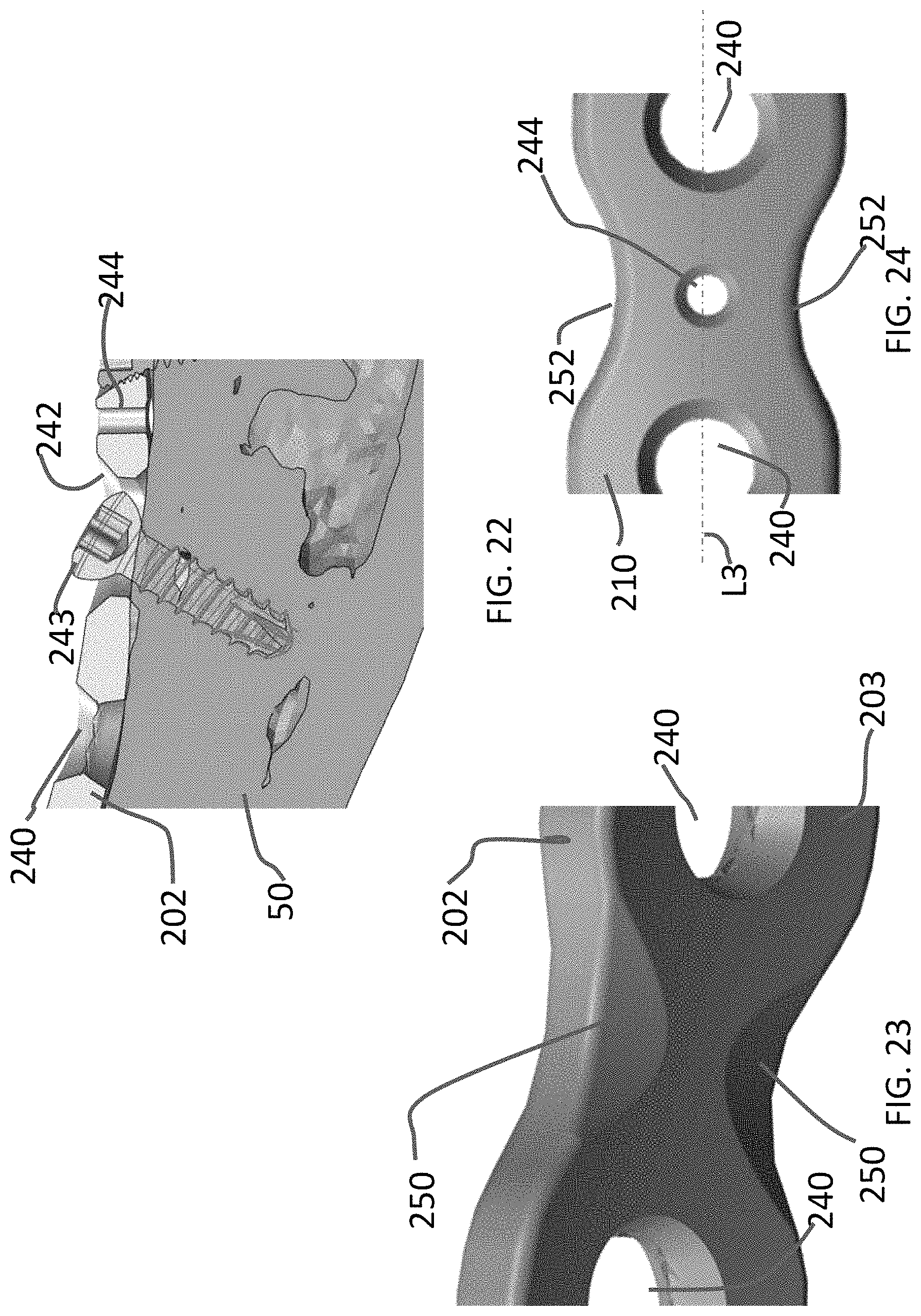 Patent US11771480 Figure 10 – Distal tibial plating system