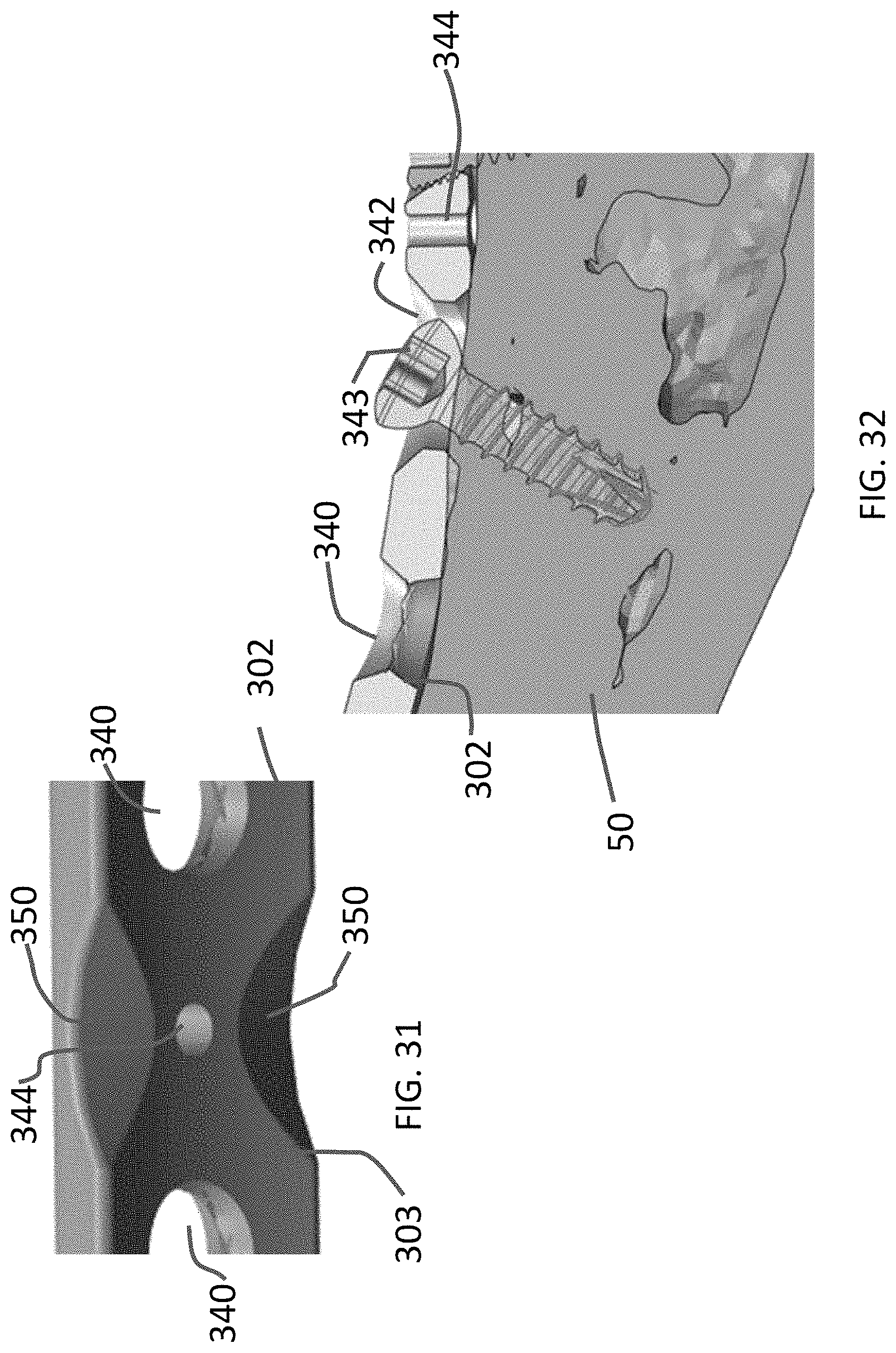 Patent US11771480 Figure 14 – Distal tibial plating system