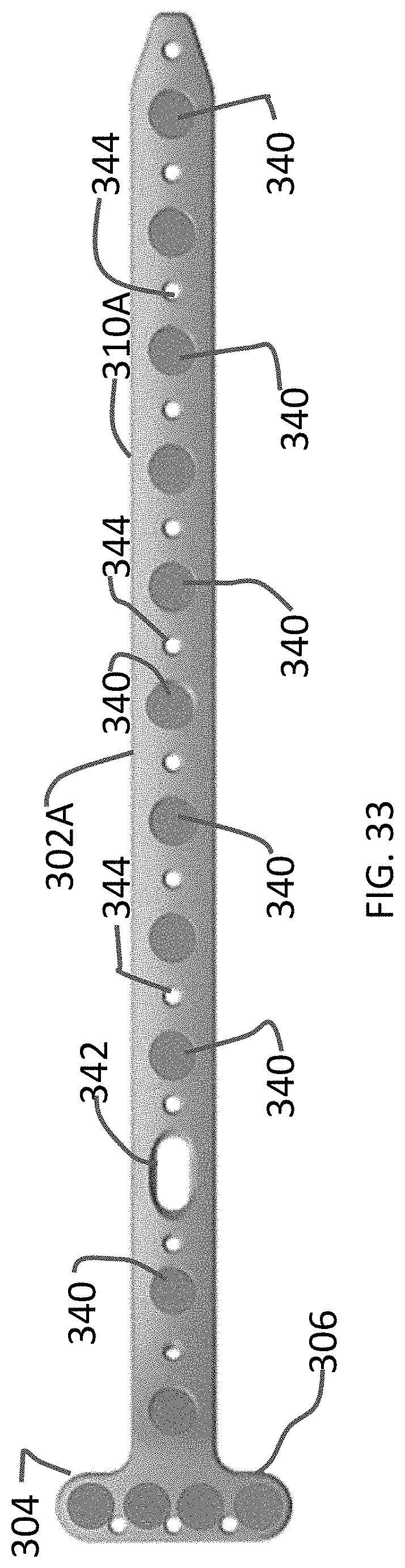 Patent US11771480 Figure 15 – Distal tibial plating system