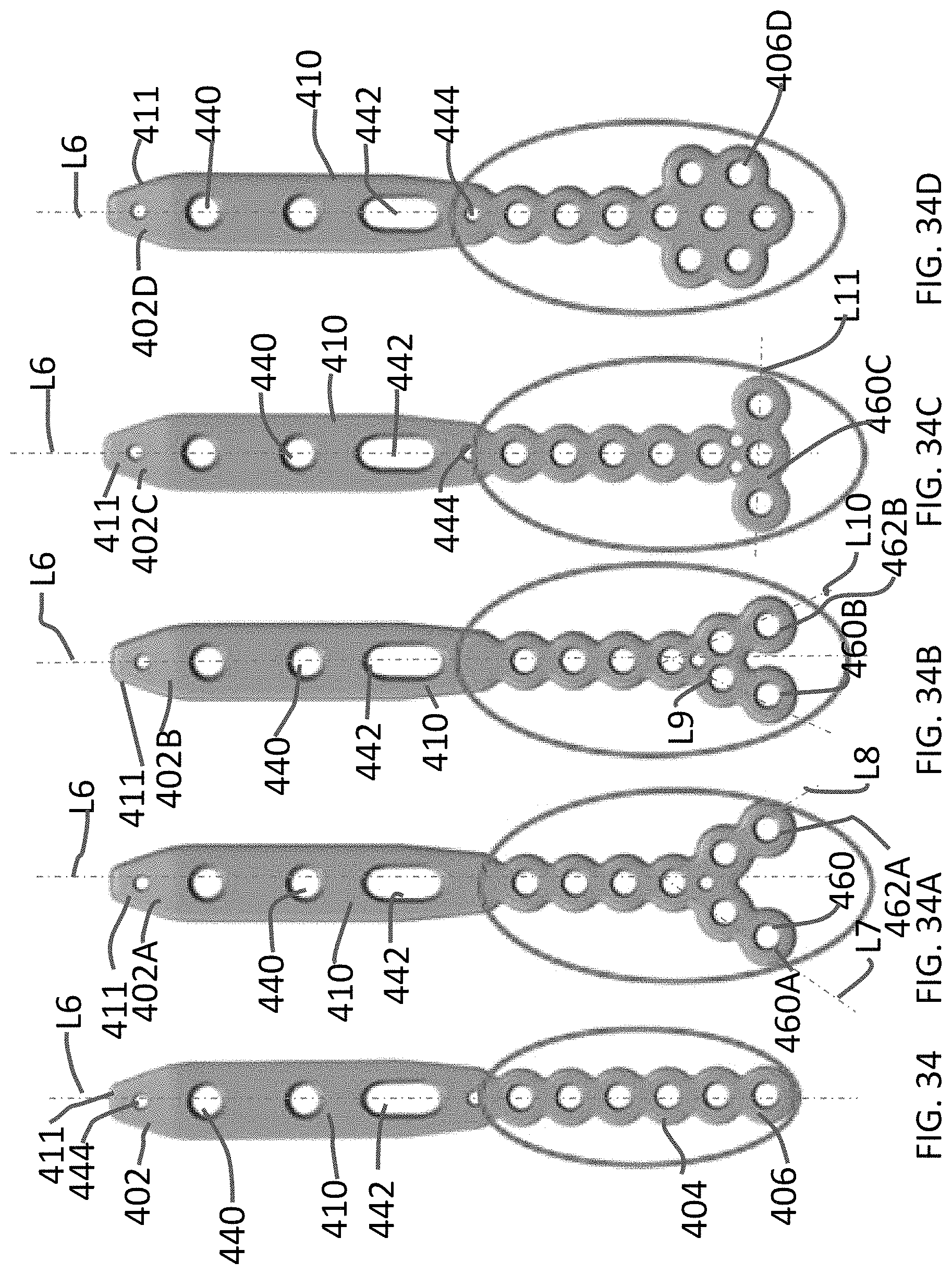 Patent US11771480 Figure 16 – Distal tibial plating system