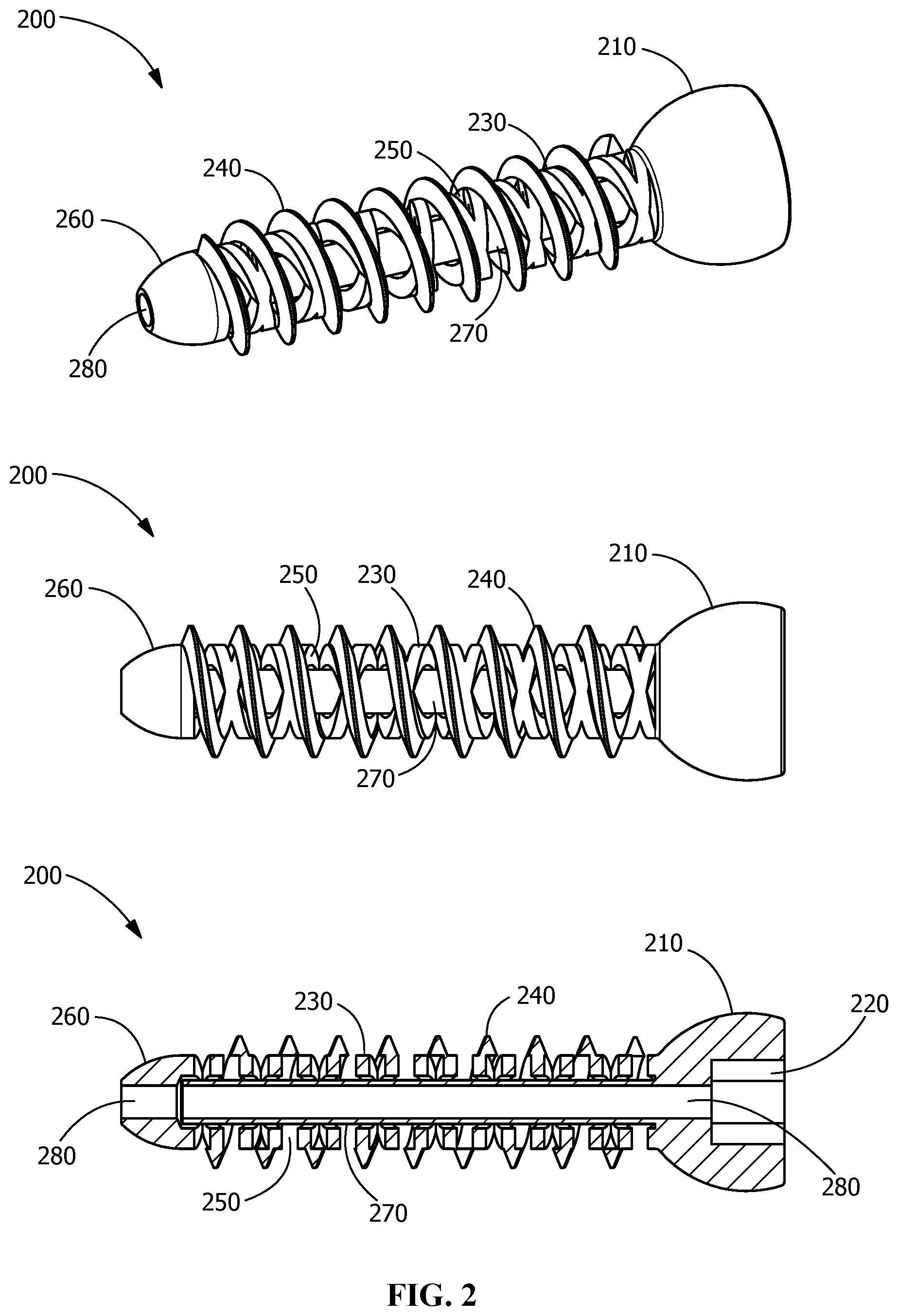 Patent US11771482 Figure 2 – Implants for tissue fixation and fusion