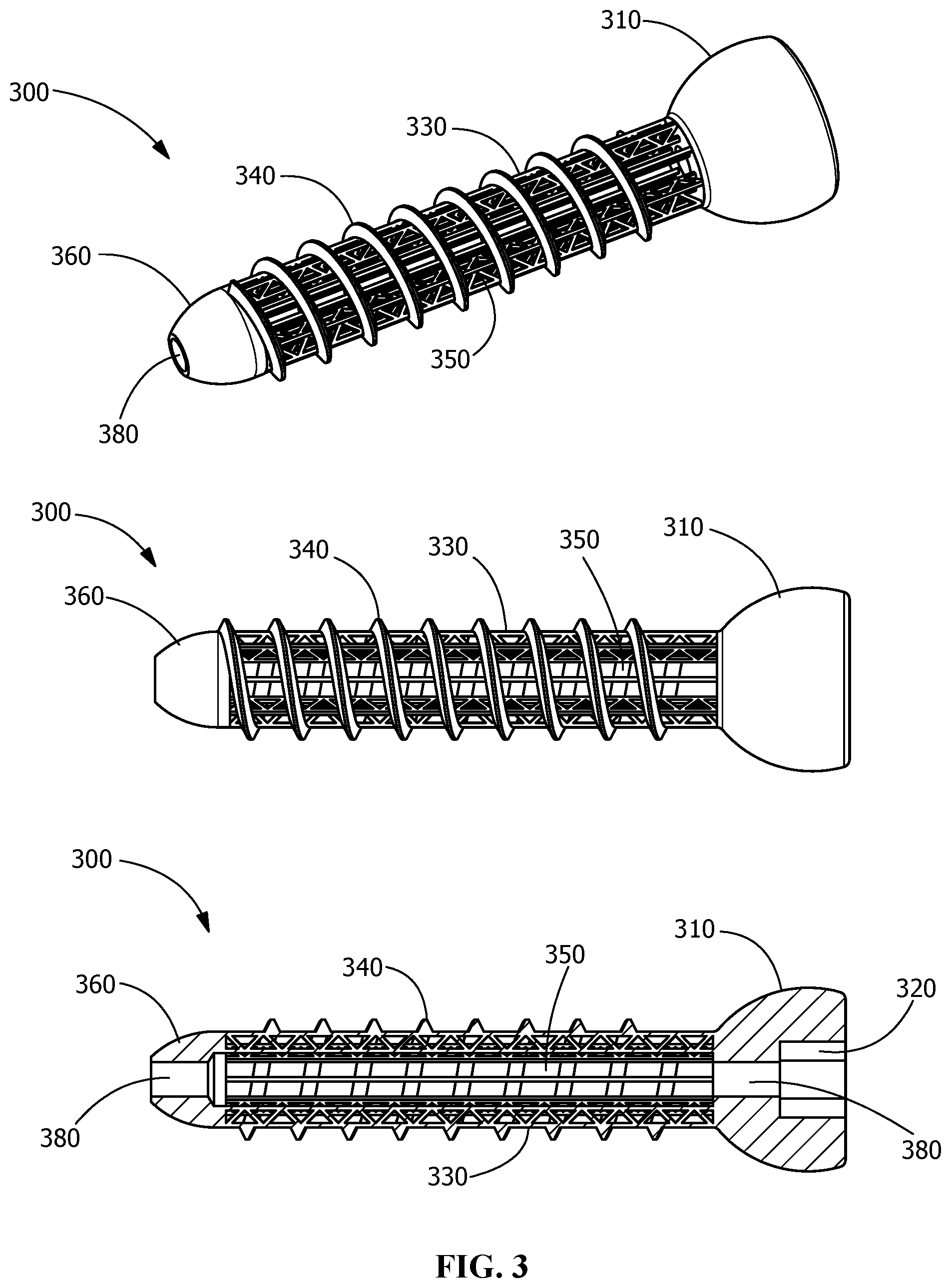 Patent US11771482 Figure 3 – Implants for tissue fixation and fusion