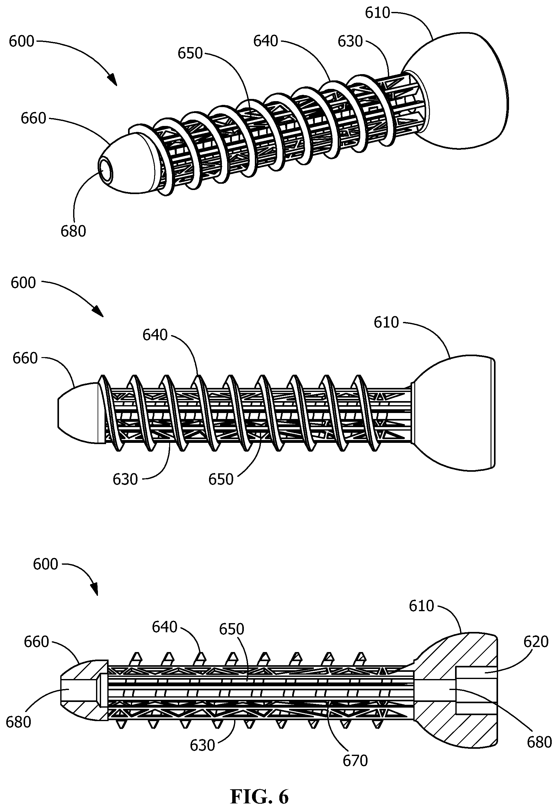Patent US11771482 Figure 6 – Implants for tissue fixation and fusion