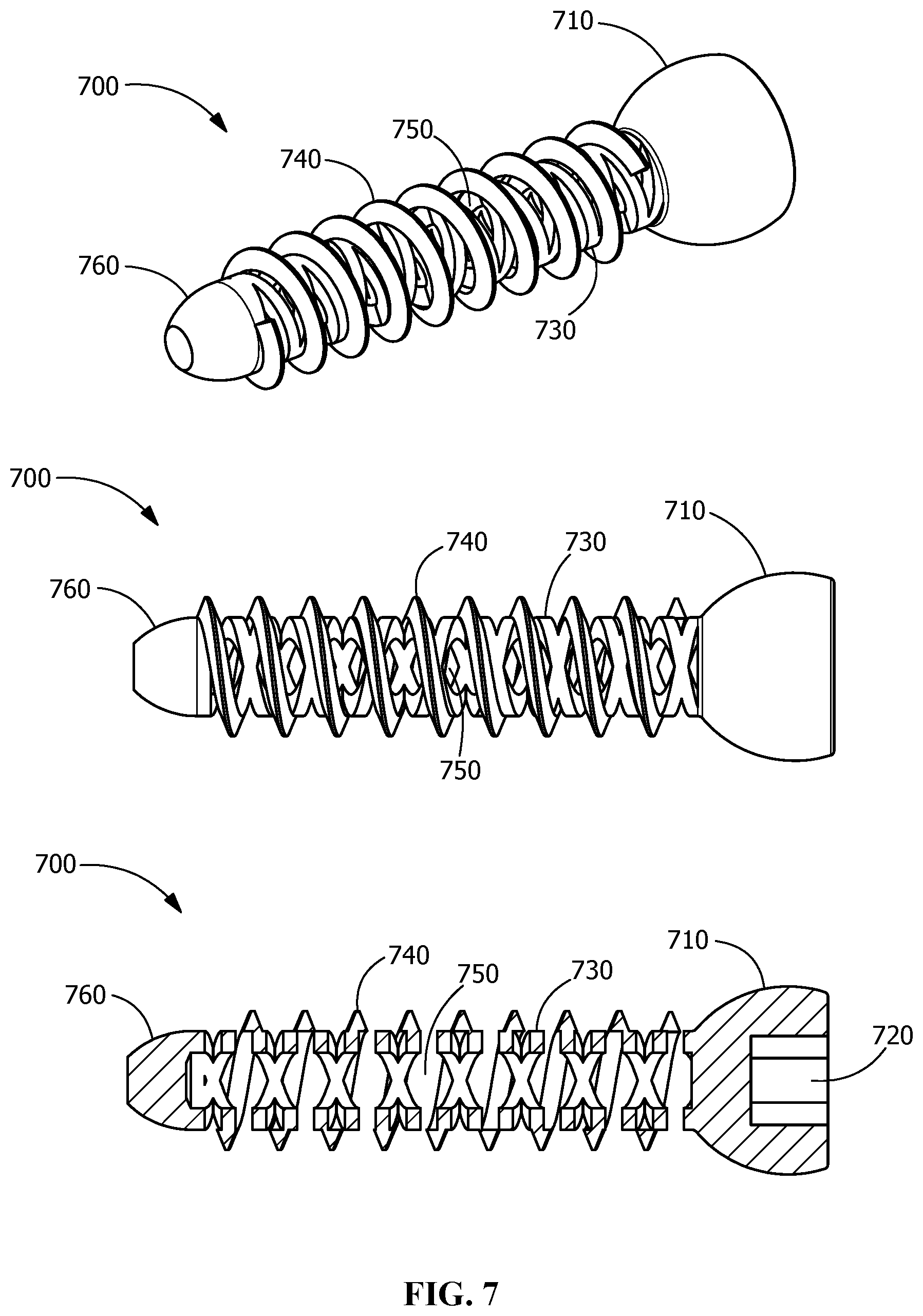 Patent US11771482 Figure 7 – Implants for tissue fixation and fusion