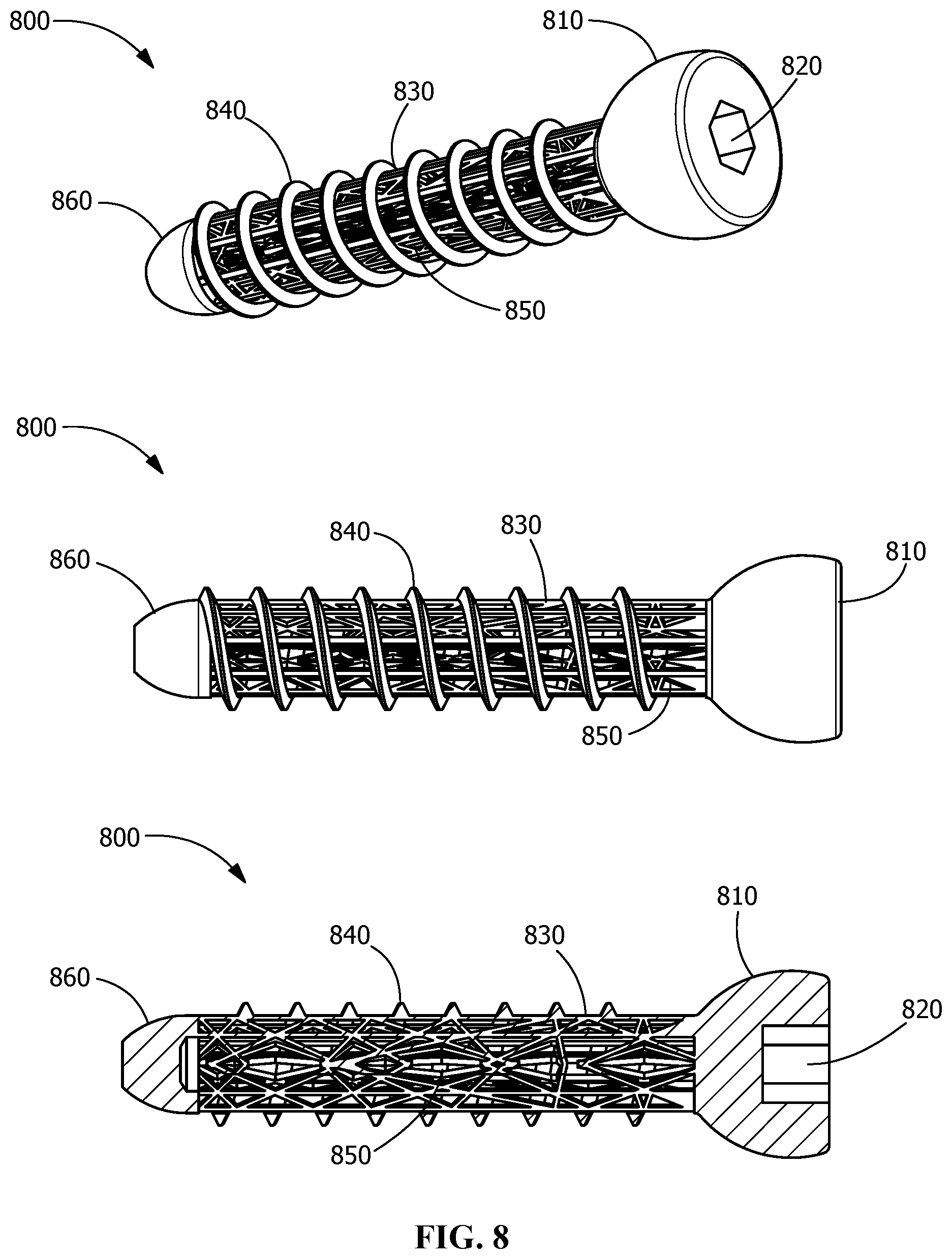 Patent US11771482 Figure 8 – Implants for tissue fixation and fusion