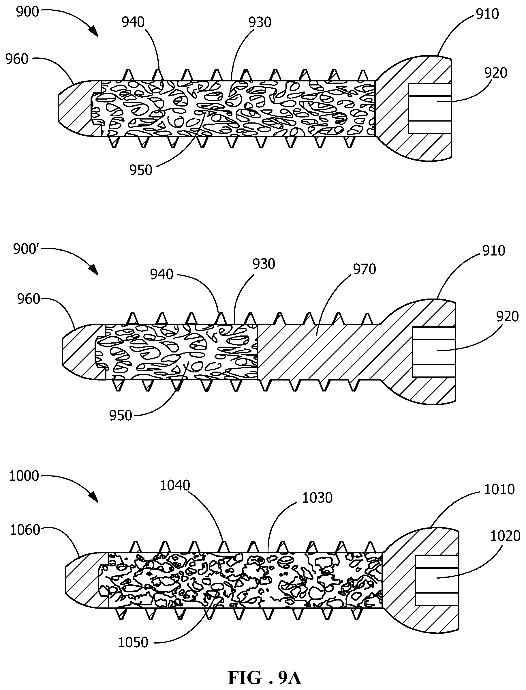 Patent US11771482 Figure 9 – Implants for tissue fixation and fusion