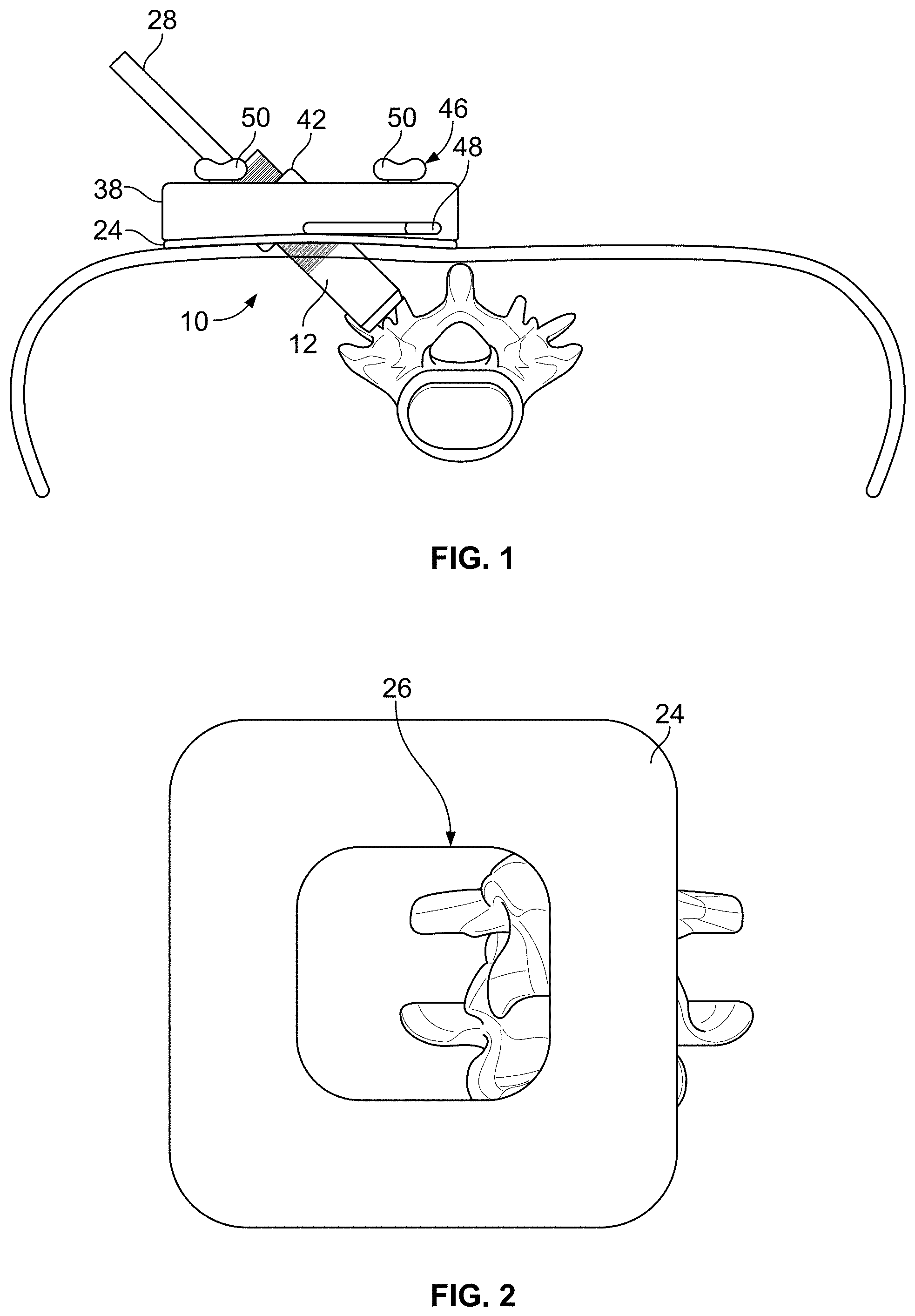 Patent US11771483 — Minimal impact access system to disc space — Figure 1