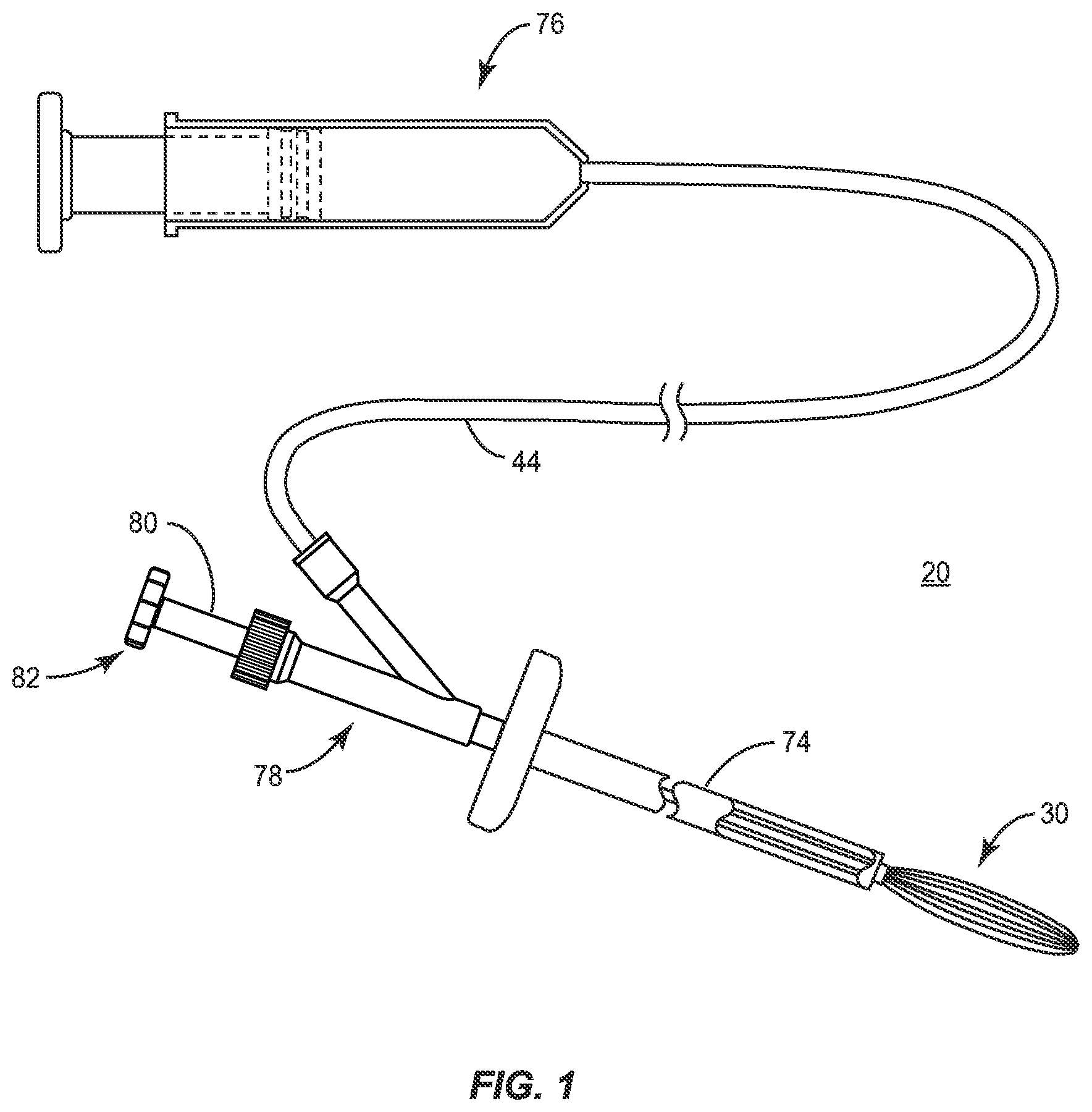 Patent US11771485 — Device for performing a surgical procedure and method — Figure 1
