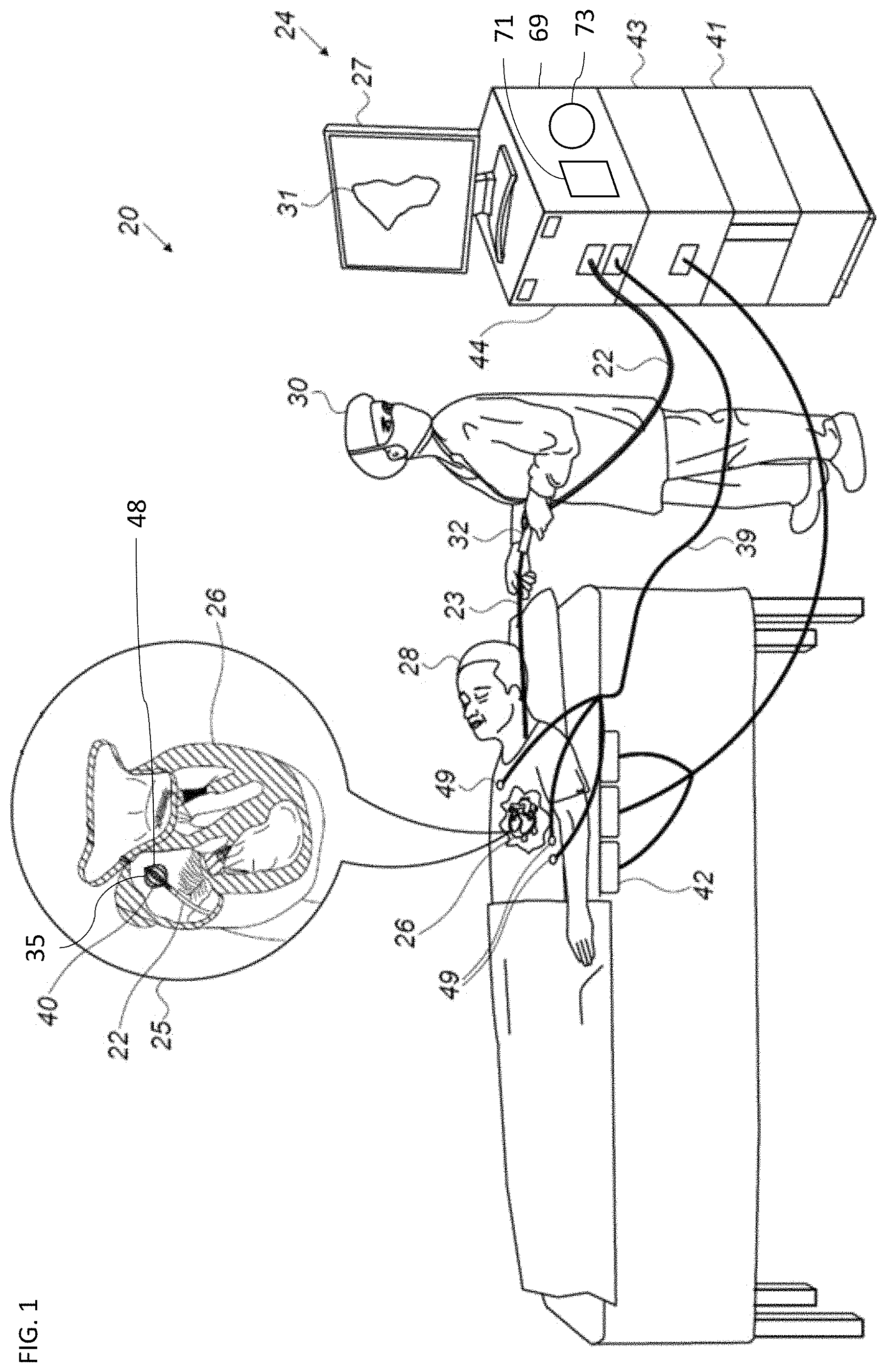 Patent US11771495 — Basket catheter with balloon — Figure 1