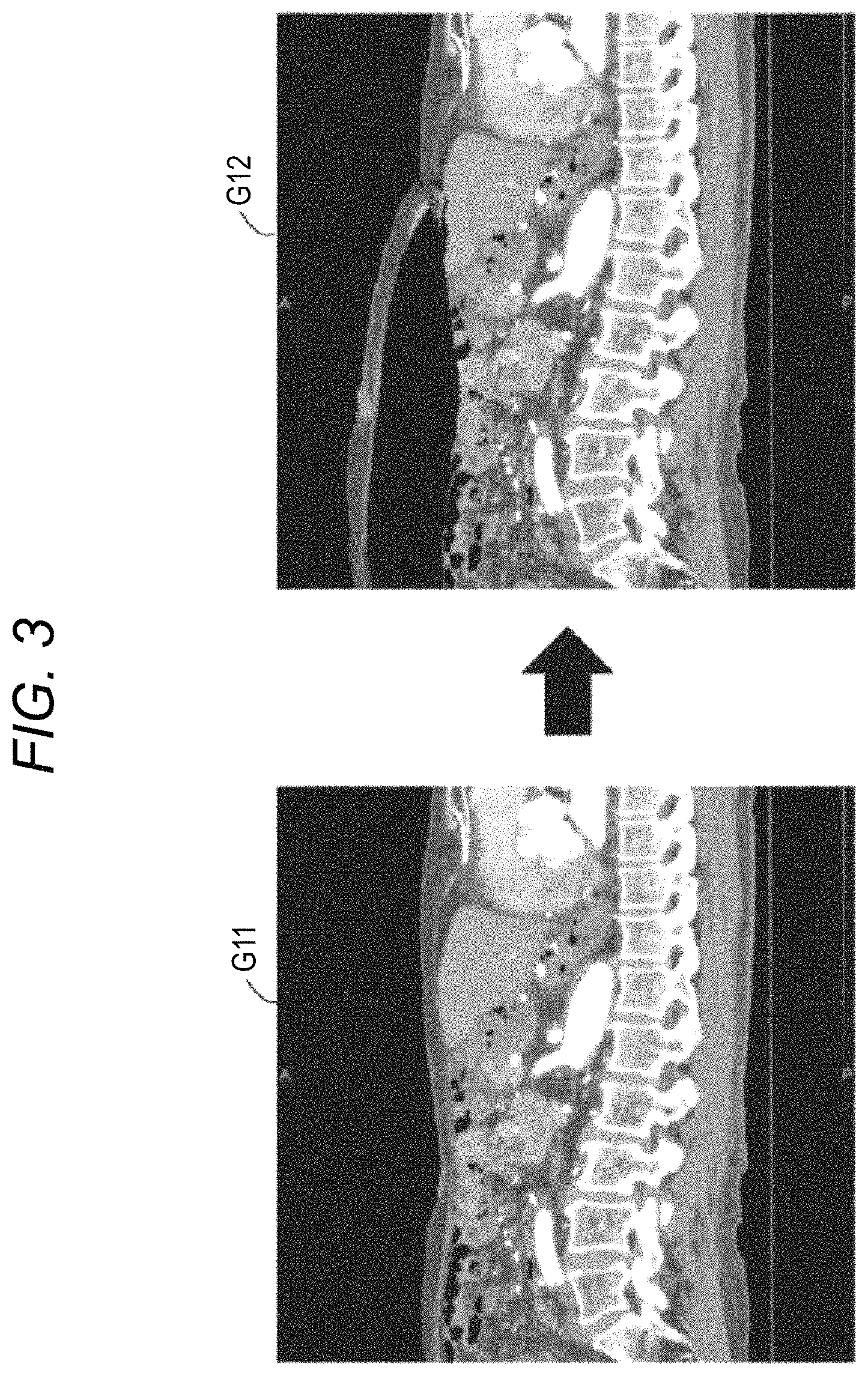 Patent US11771508 Figure 3 – Robotically-assisted surgical device, robotically-assisted surgery method, and system