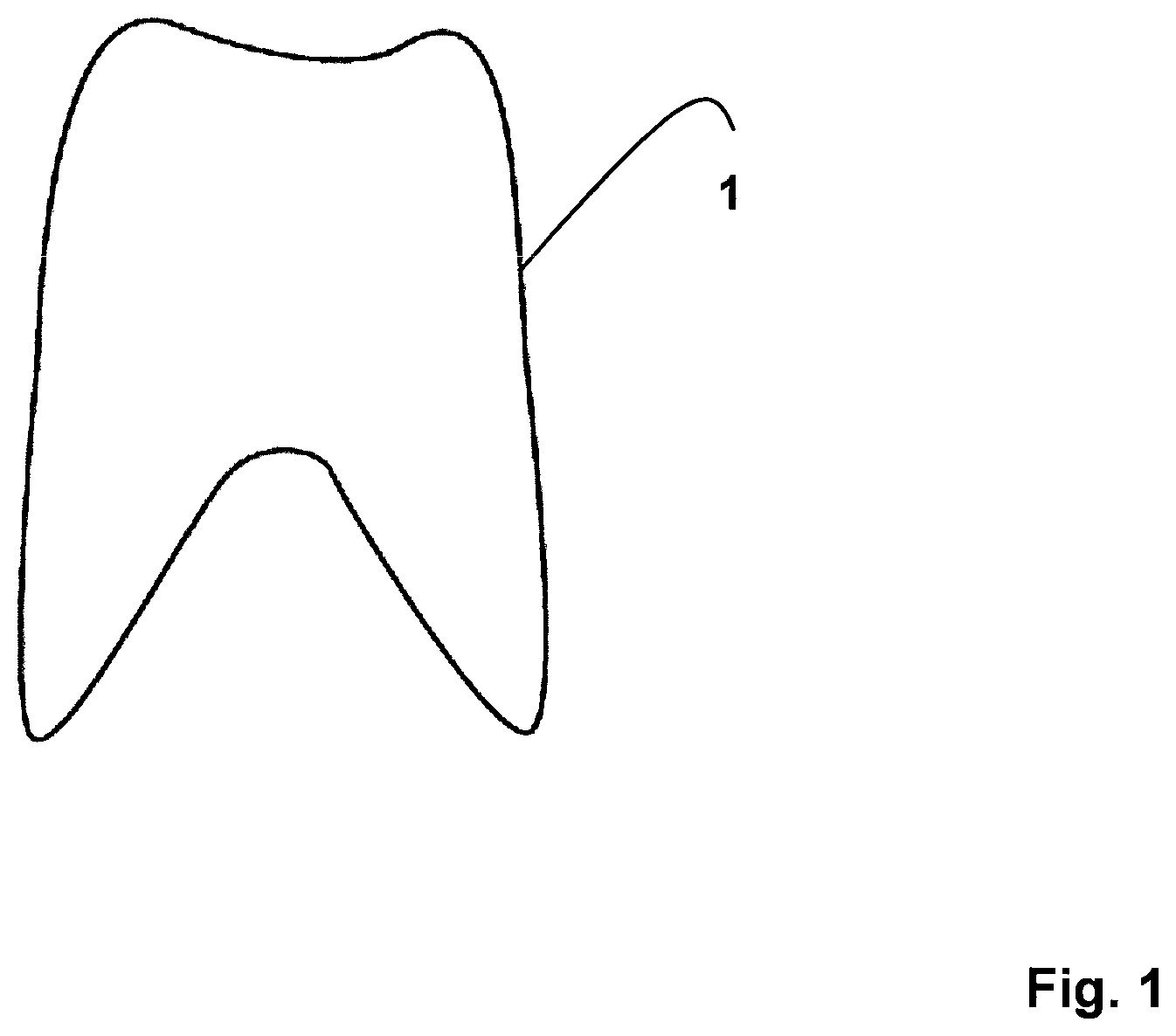 Patent US11771523 Figure 1 – Method for the design and manufacture of a dental component