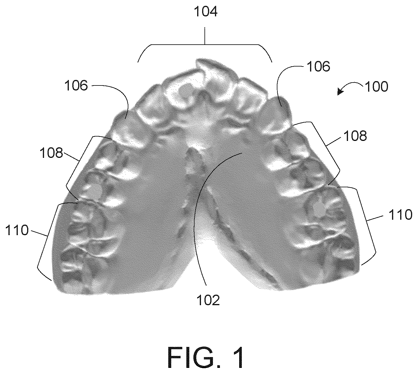 Patent US11771527 — Limited wear aligner and treatment methods — Figure 1