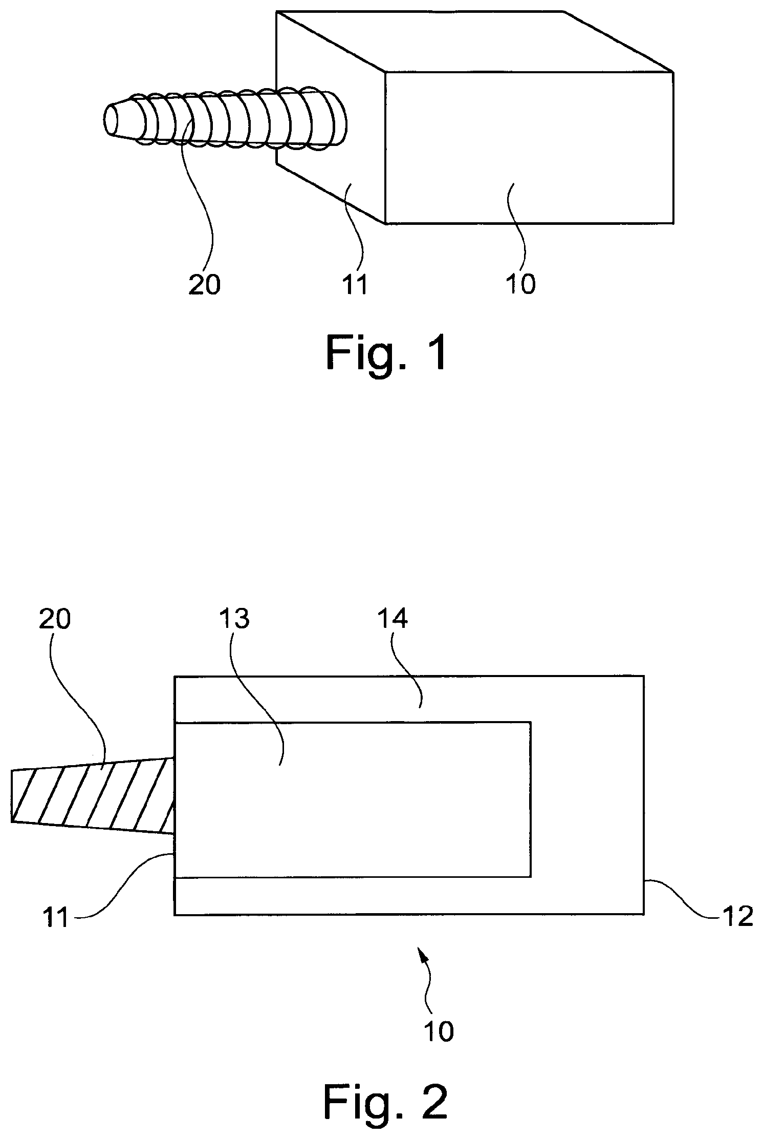Patent US11771530 — Dental prosthesis forming block and method for producing a dental prosthesis from the dental prosthesis forming block — Figure 1