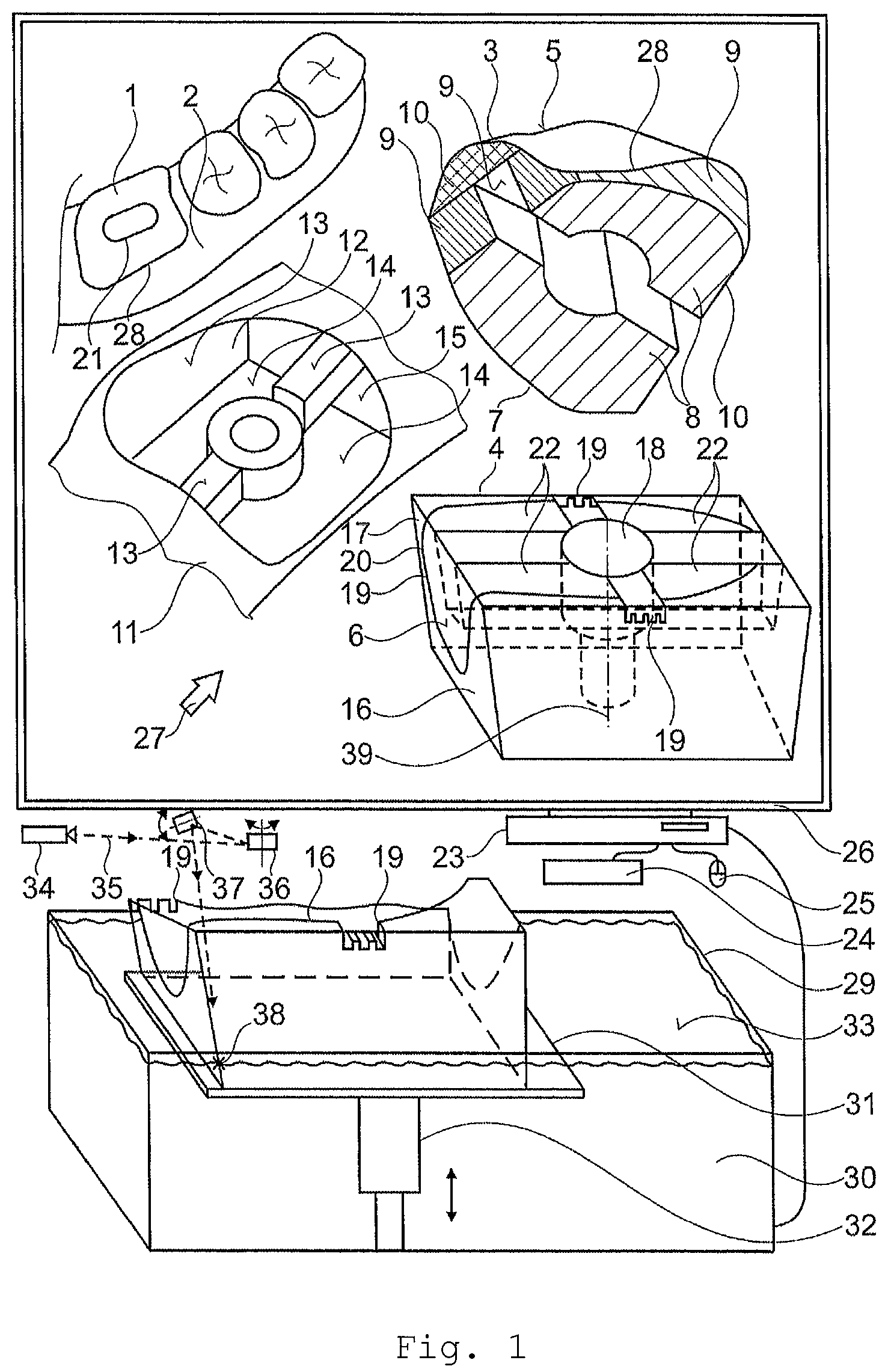Patent US11771533 — Method for producing an artificial gingiva — Figure 1