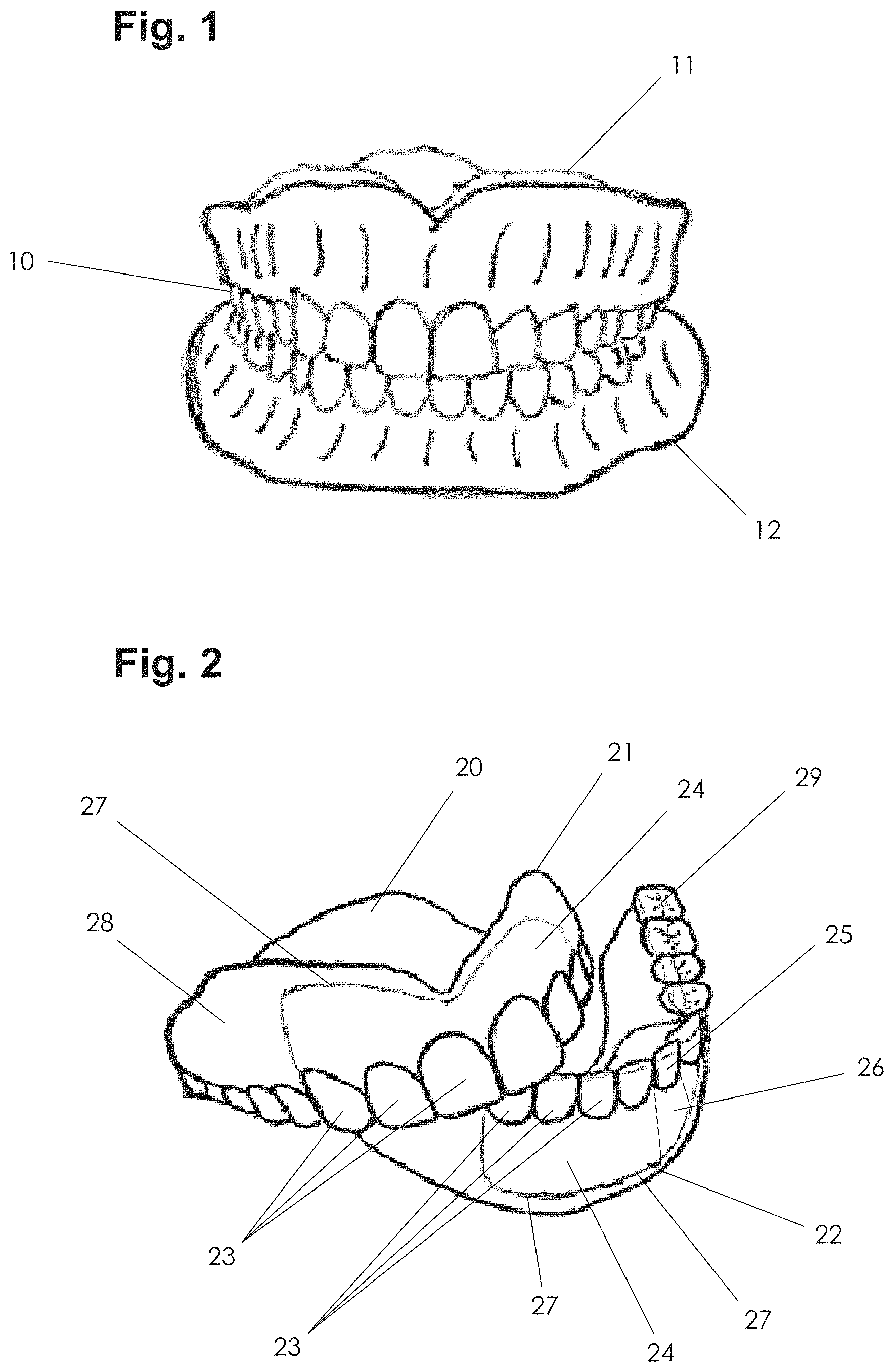 Patent US11771535 — Apparatus and methods of making denture devices — Figure 1