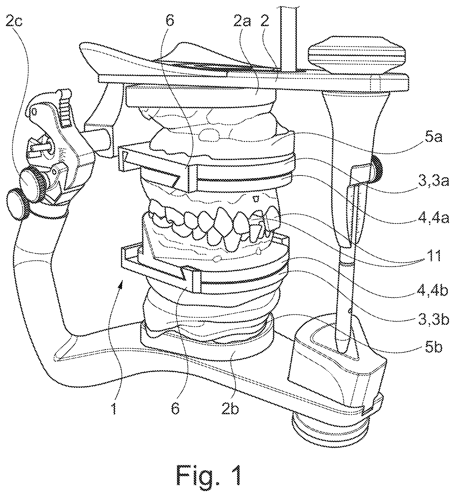 Patent US11771536 Figure 1 – Method for producing a dental working model
