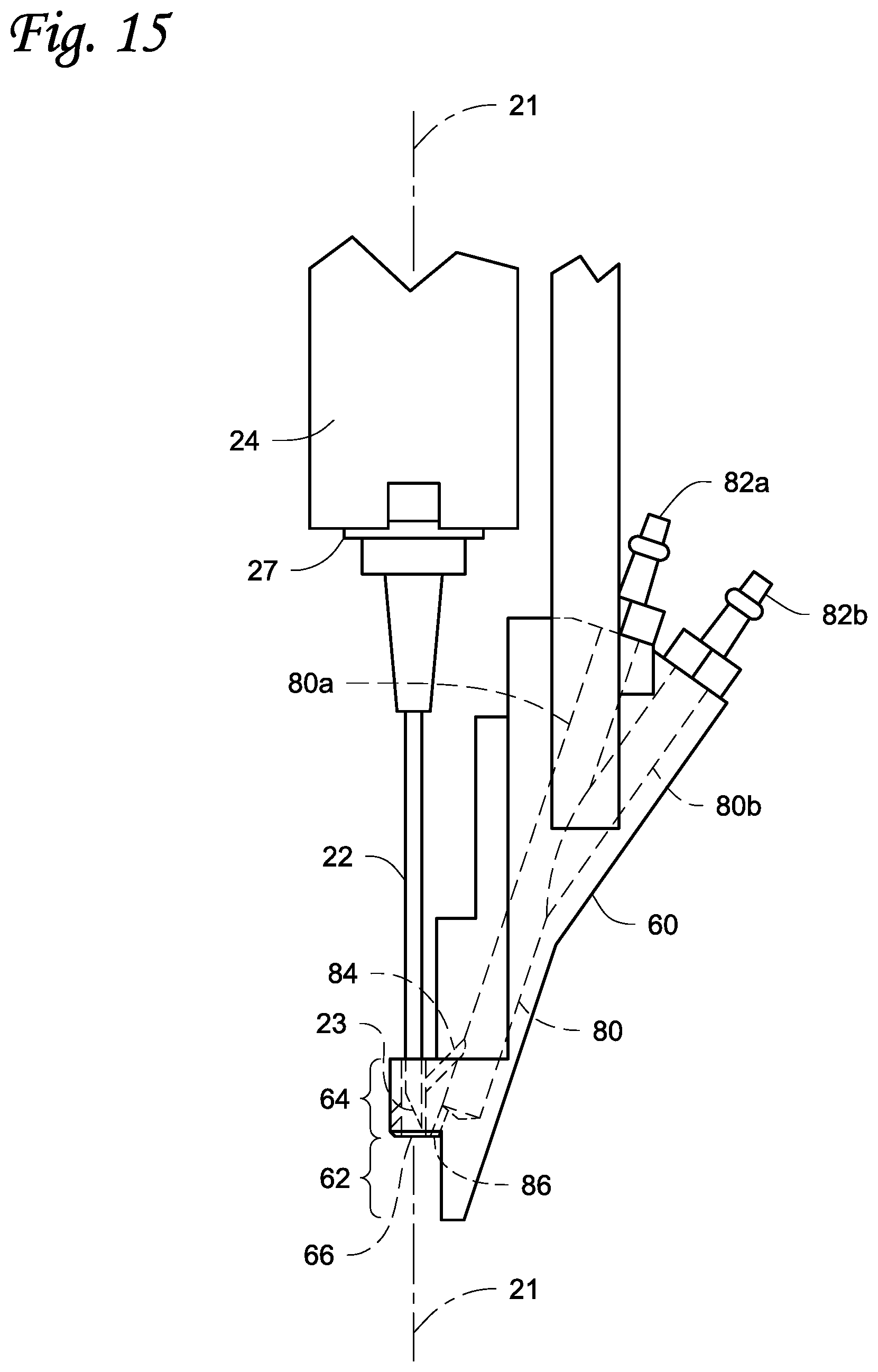 Patent US11771538 Figure 14 – Injection systems and methods